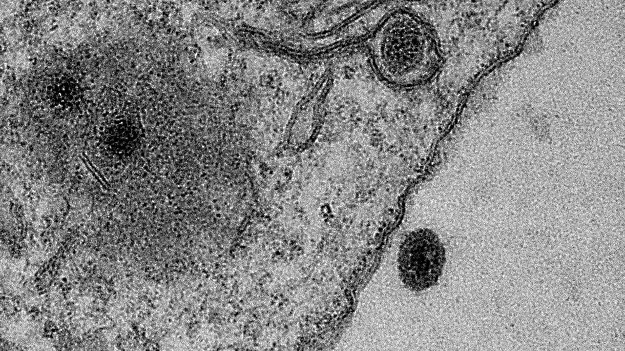 Анализ генома нового вируса амеб не нашел у него родственников