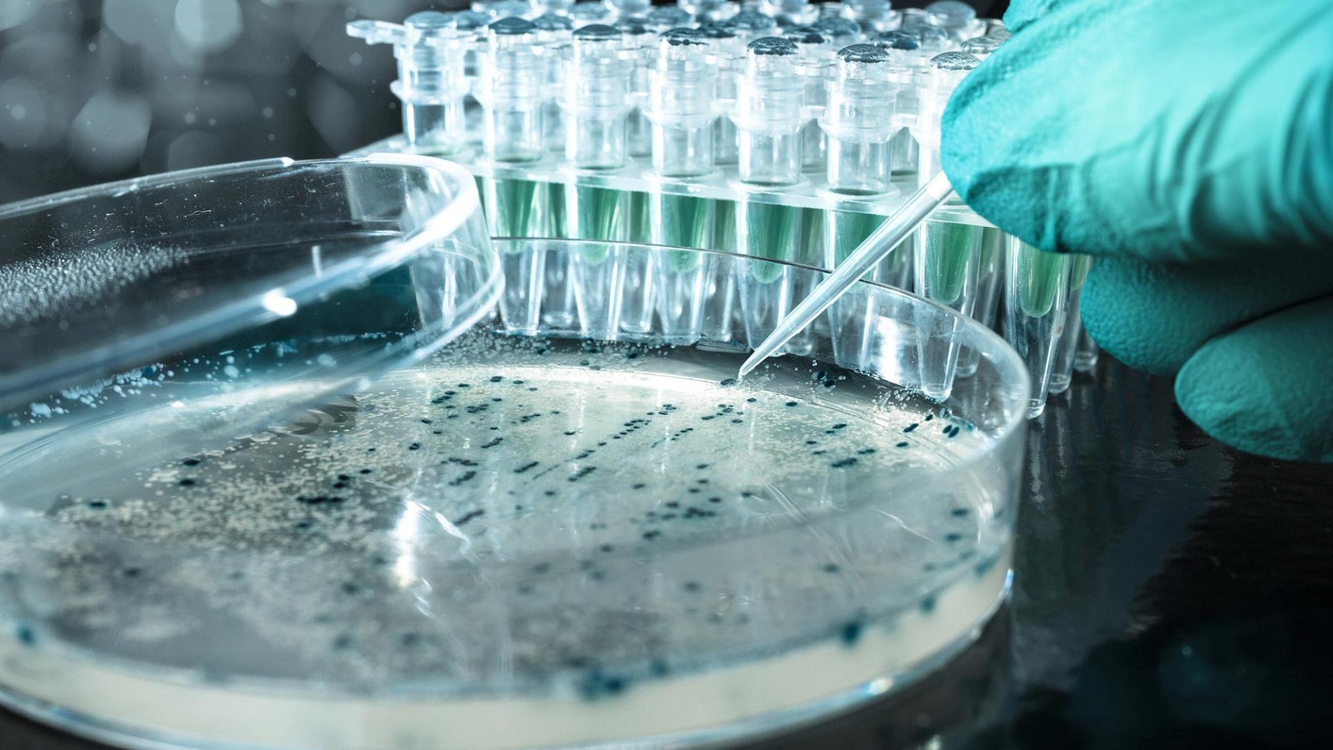 Удалось обнаружить микроорганизм, который поможет перерабатывать пластик на основе полиуретана