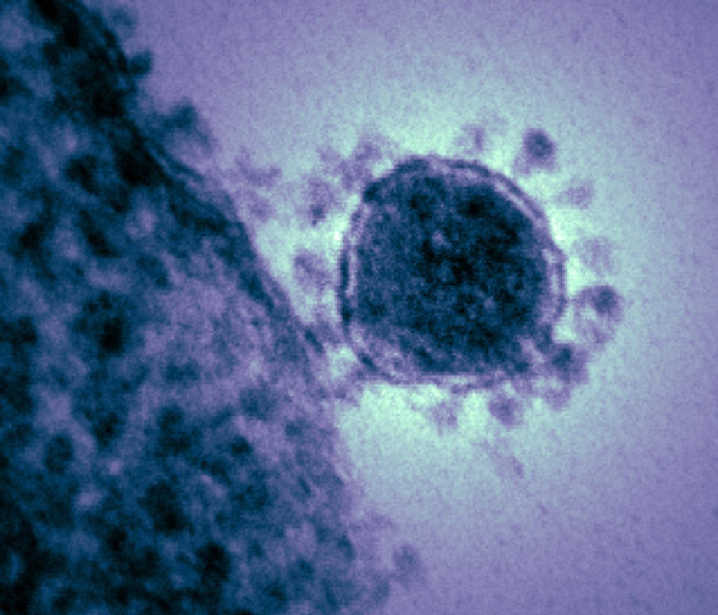 Открыто первое антитело, блокирующее новый коронавирус. Но до лекарства пока далеко