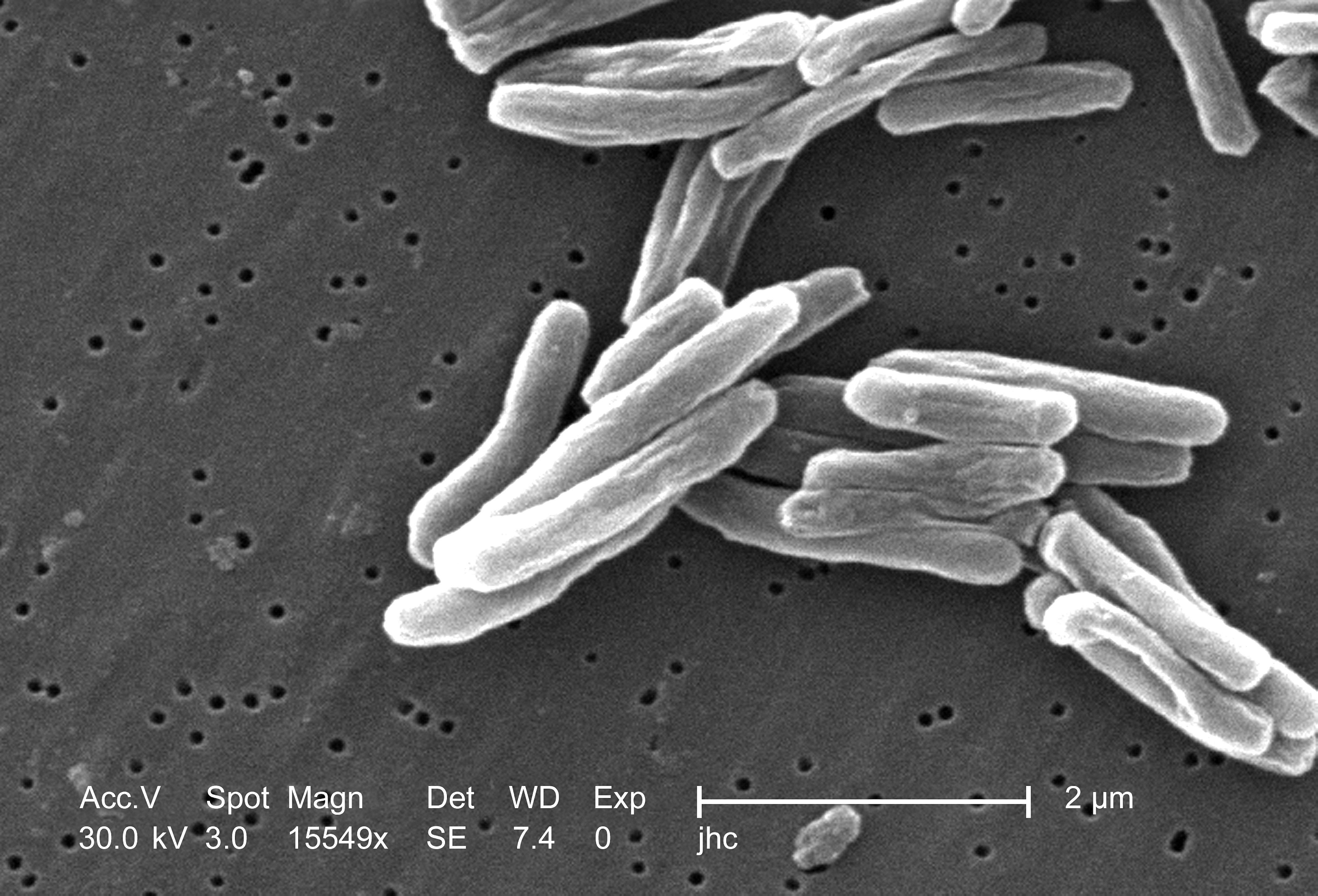Объяснено, как бактерия туберкулеза импортирует витамин В12, необходимый ей для размножения