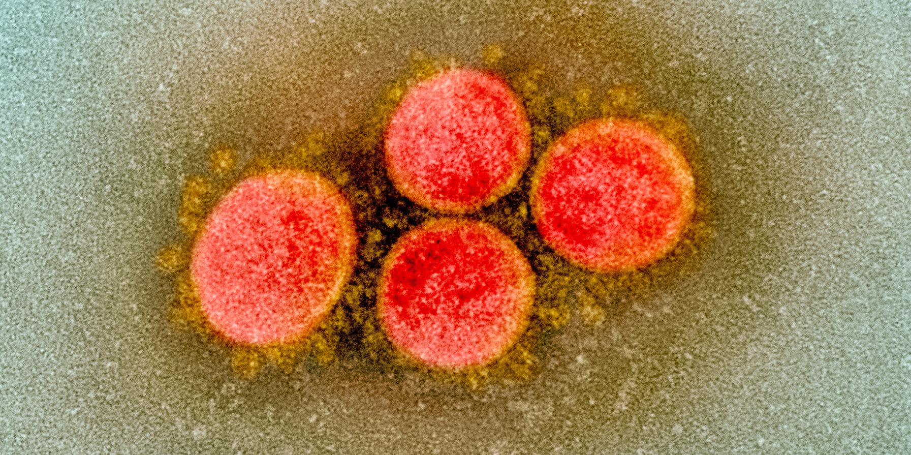 Почему новый коронавирус вызывает сильное воспаление?