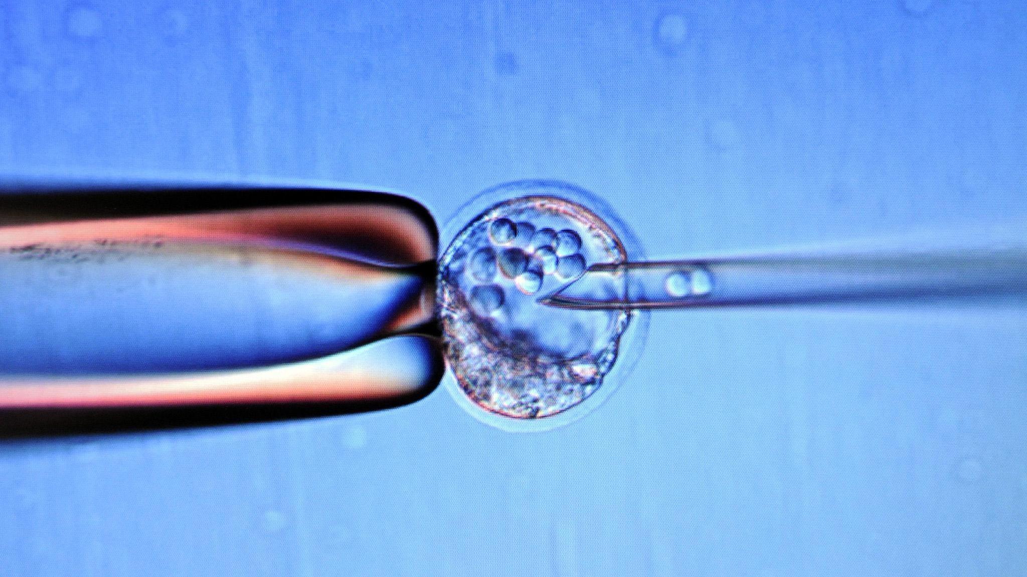 Ученые превратили стволовые клетки в клетки печени и впервые успешно пересадили их младенц