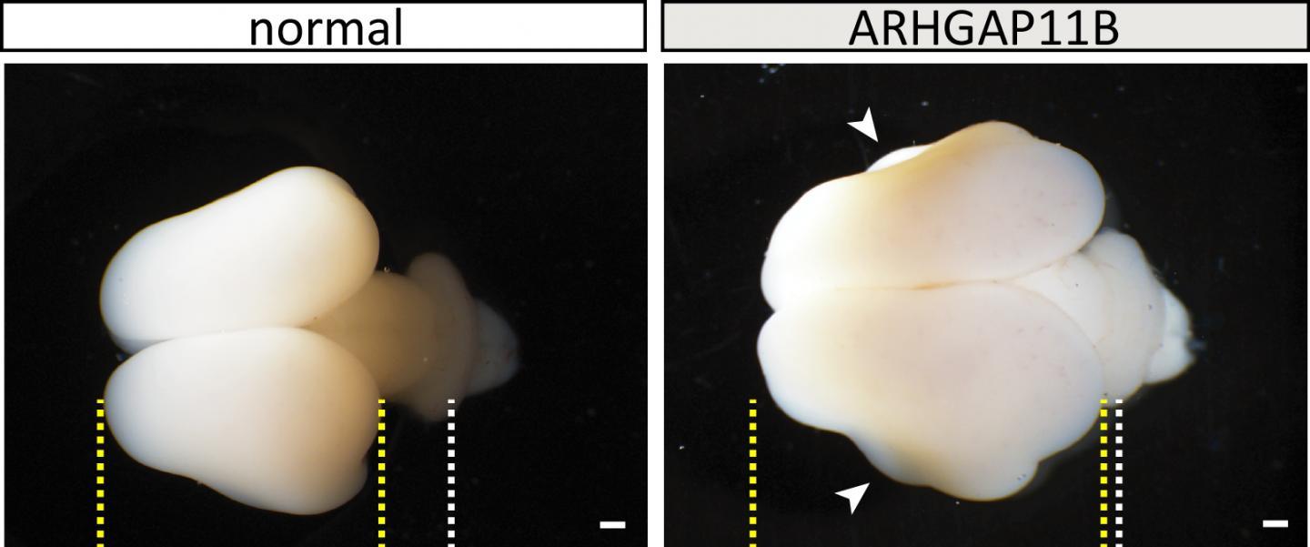 Биологи вырастили зародыш мартышки с более «человеческой» корой мозга