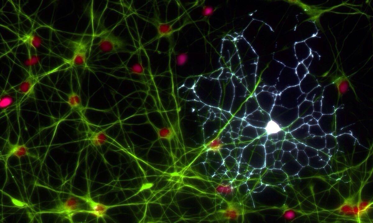 Вспомогательные клетки мозга тормозят болезнь Паркинсона
