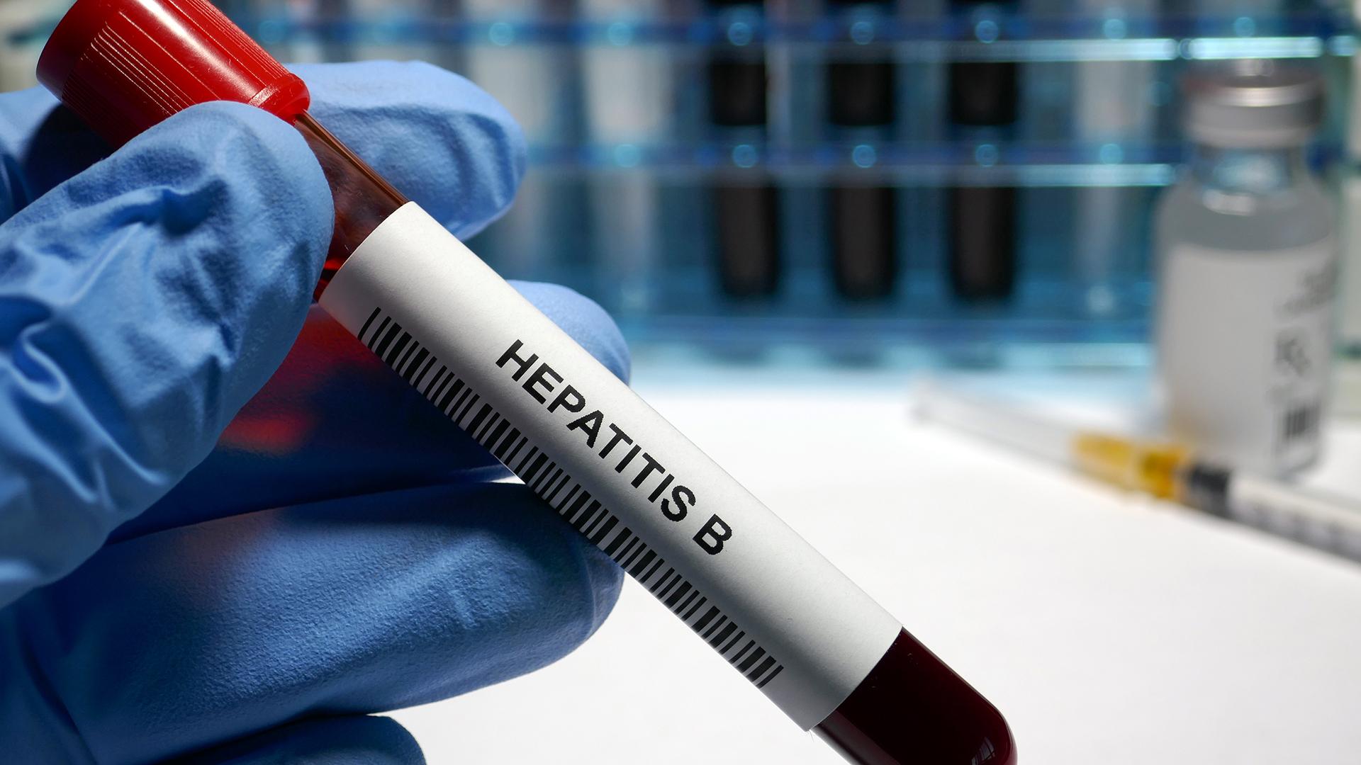 У вируса гепатита В обнаружили долгую историю