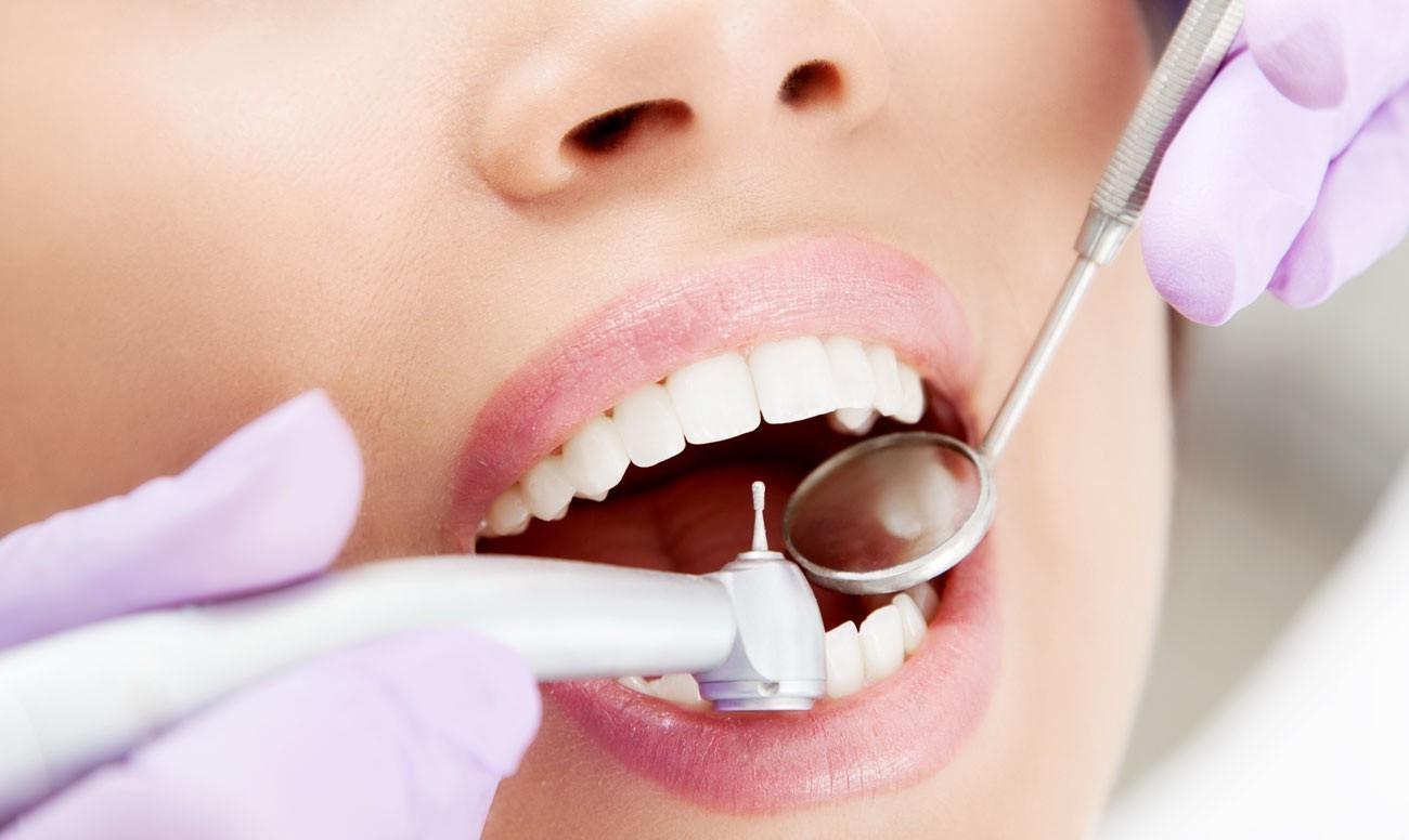 Как лечить кариес зубов: советы от стоматологии в Воронеже