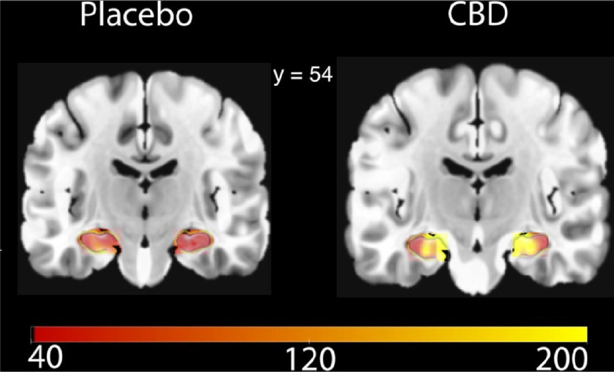 Каннабидиол улучшает кровоток в «запоминающей» области мозга