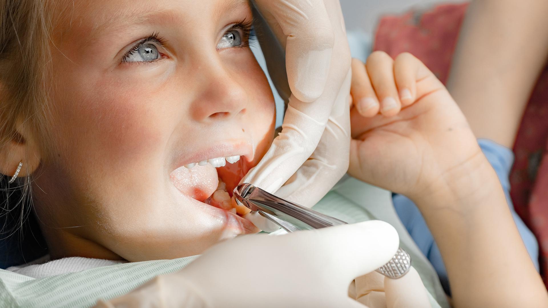 Услуги детской стоматологии