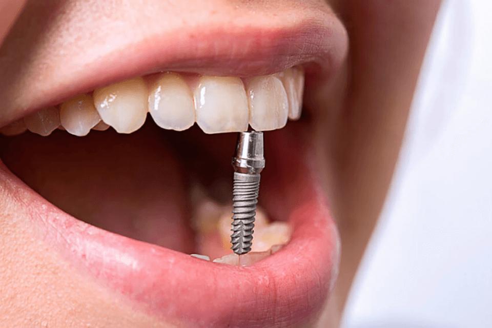 Возможности современного стоматологического лечения
