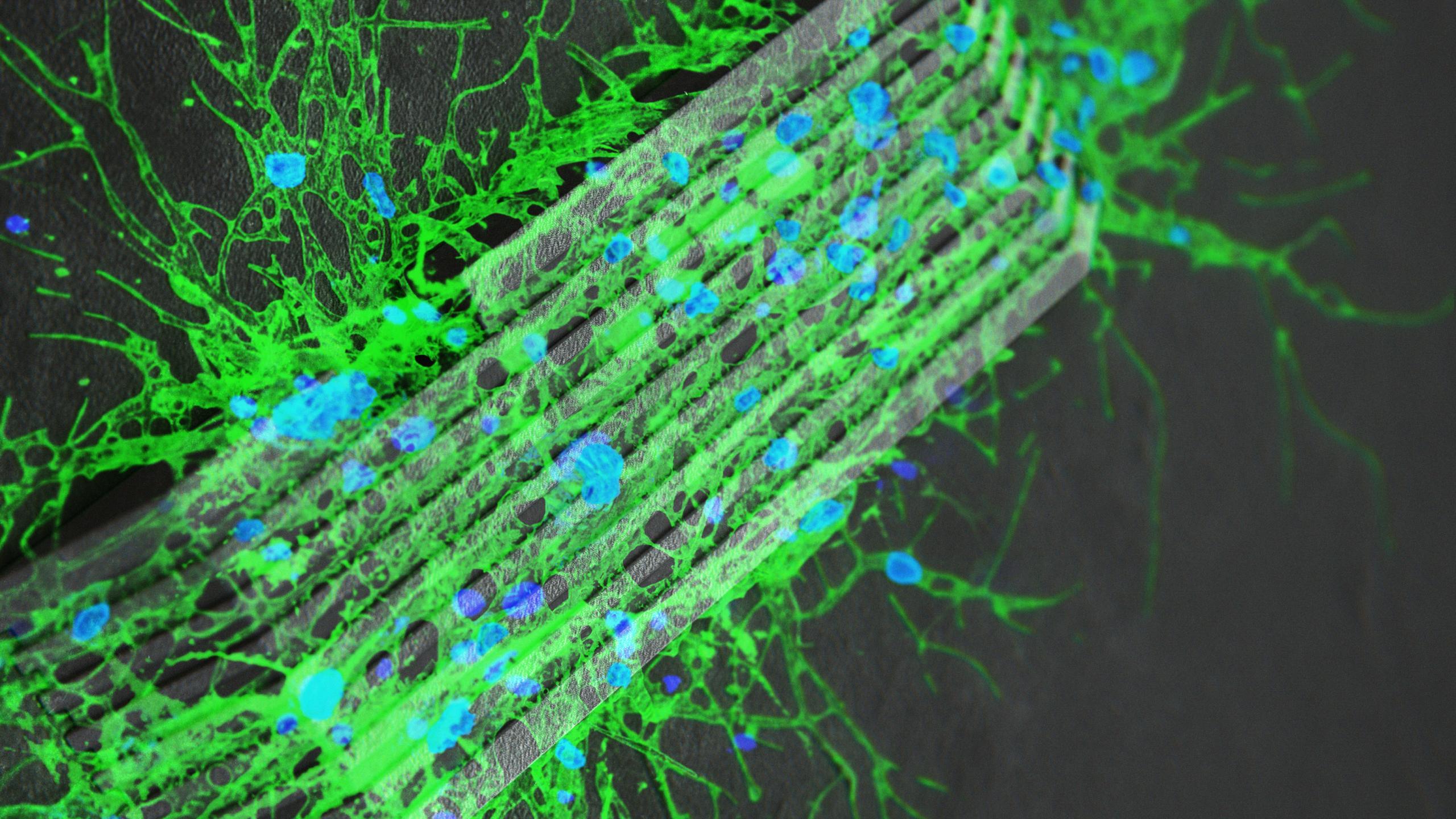 «Биостанции» из микророботов помогут восстанавливать связи между нейронами