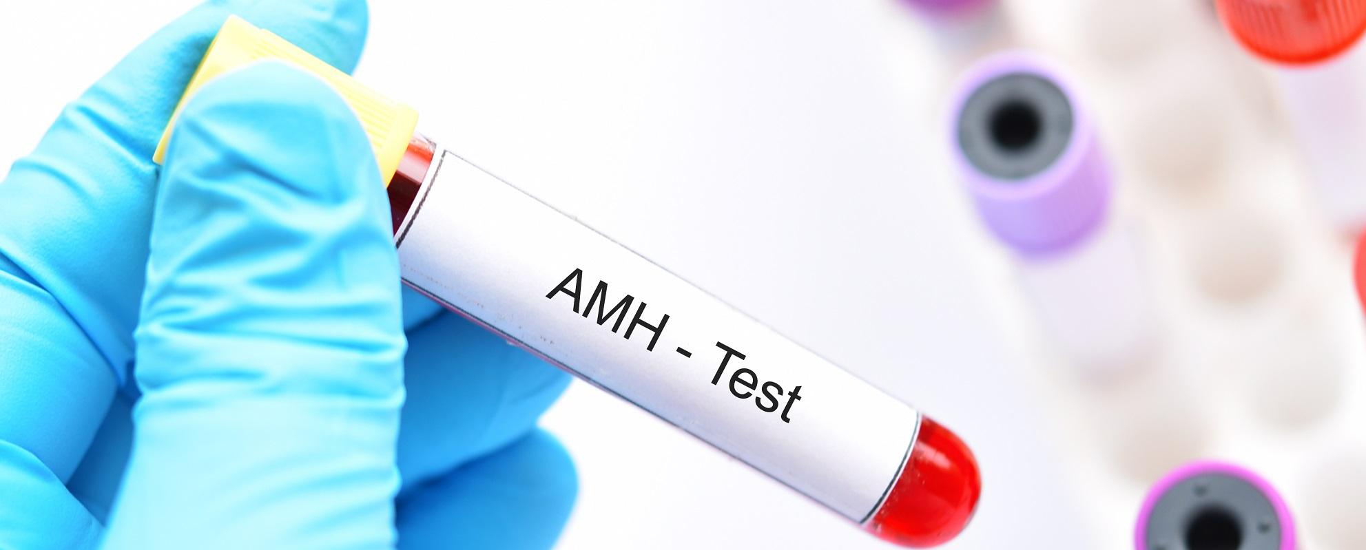 Что происходит в тесте AMH?