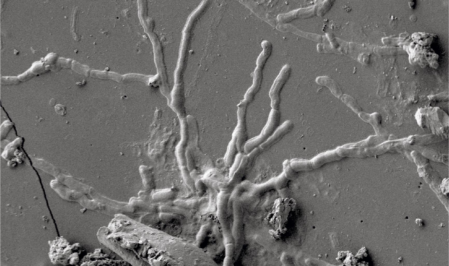Вулкан на службе нейронаук: обнаружены 2000-летние нейроны человеческого мозга