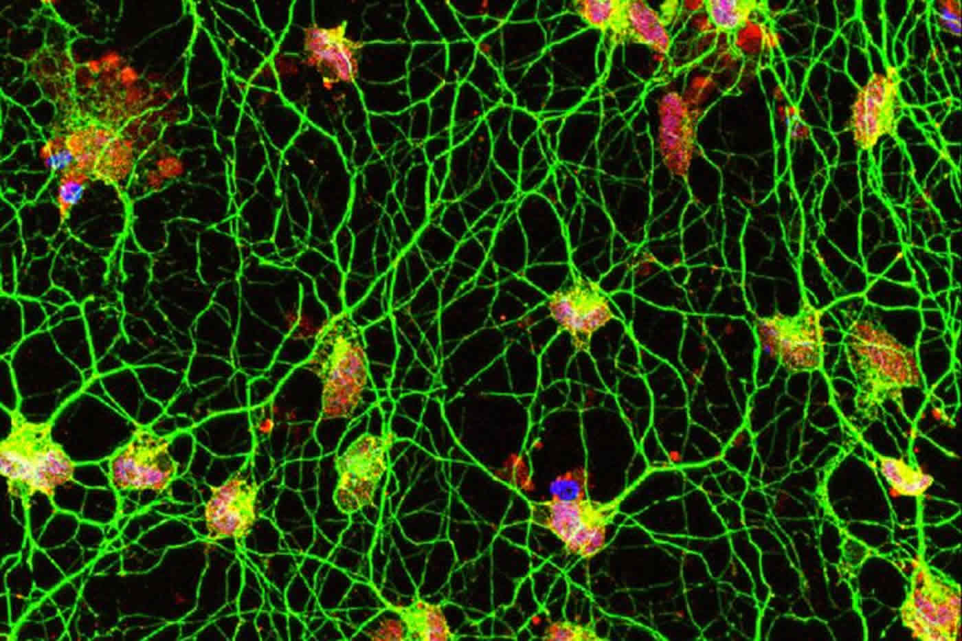 Как сделать нейроны из кожи, не затрагивая гены