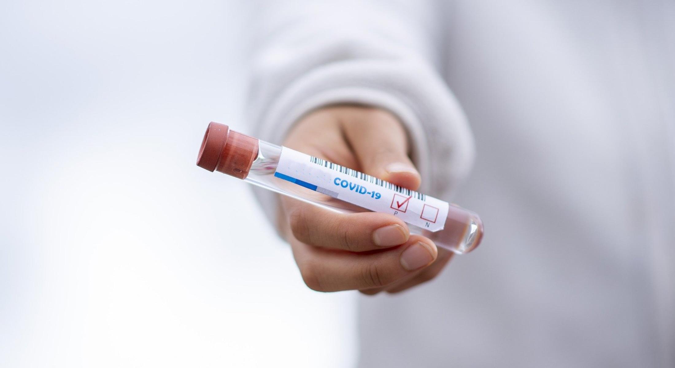Люди с ослабленным иммунитетом могут оставаться заразными после COVID-19 в течение двух месяцев