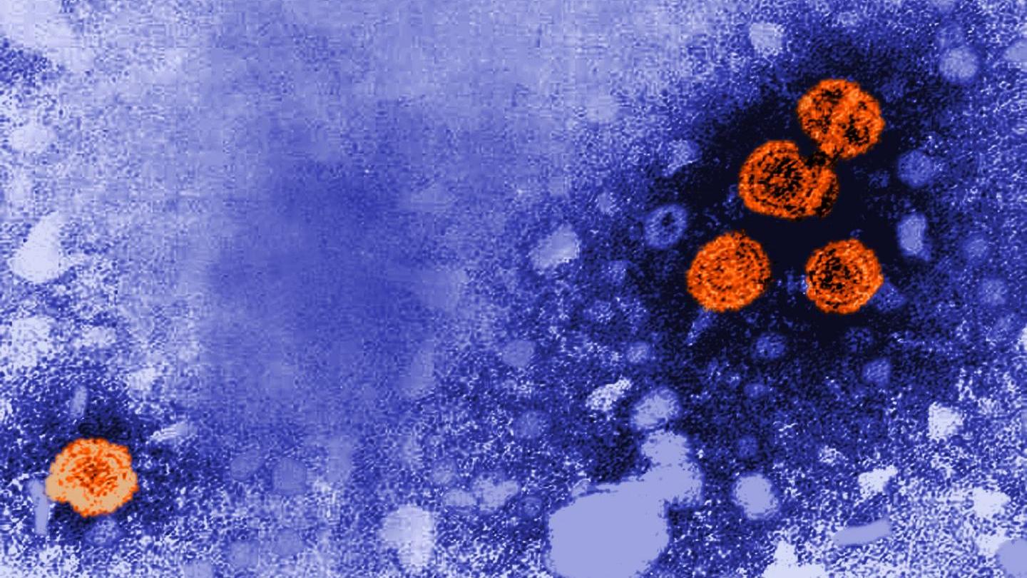 Биологи разработали два новых метода терапии гепатита B