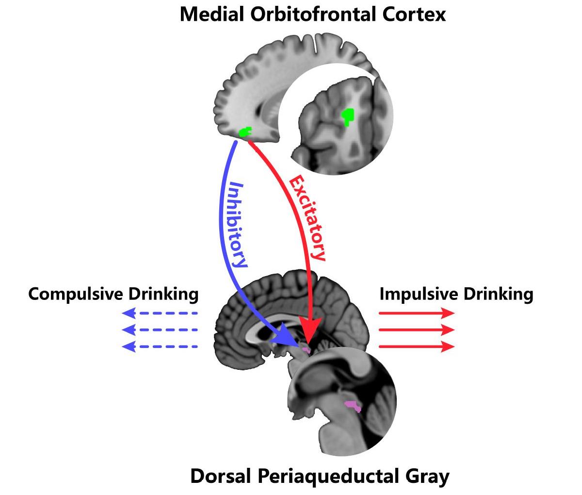 Идентифицирована нейронная сеть, ответственная за склонность к алкоголизму