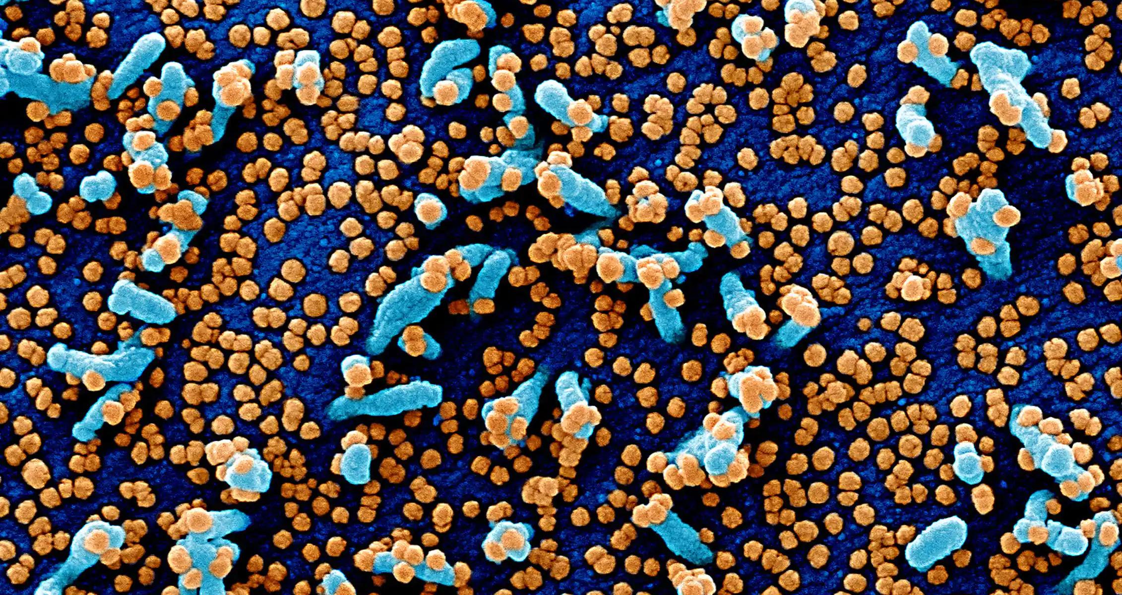 «Лучик» короны коронавируса вскрывает гемато-энцефалический барьер