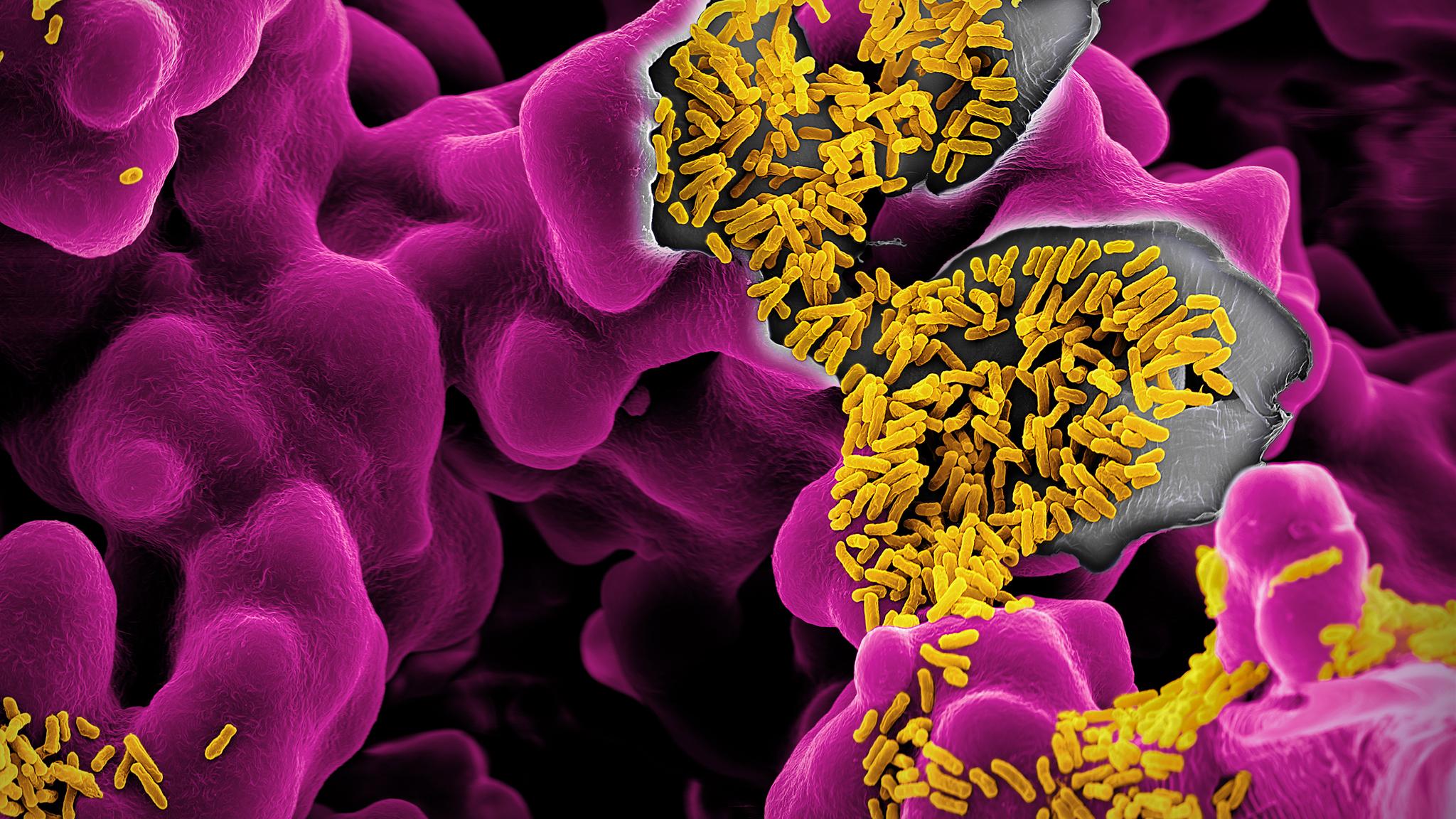 Биологи получили ГМ-бактерии, уничтожающие рак