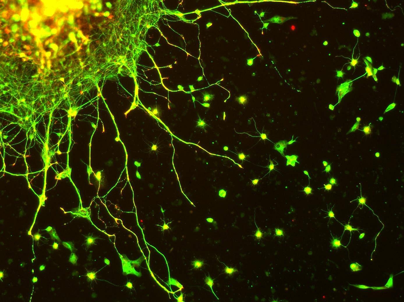 Как новые нейроны приживаются в мозге после инсульта