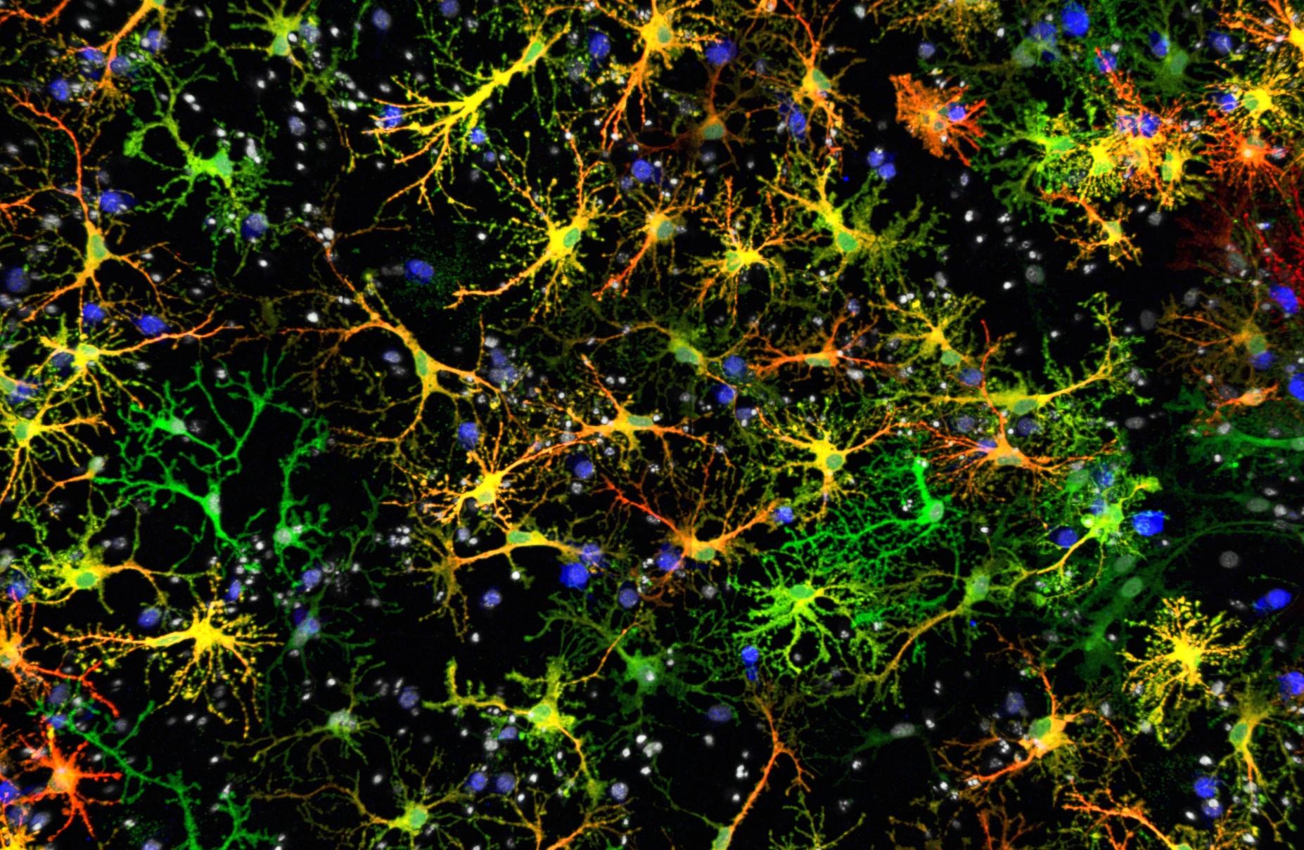 Служебные клетки мозга помогают нейронам учить движения