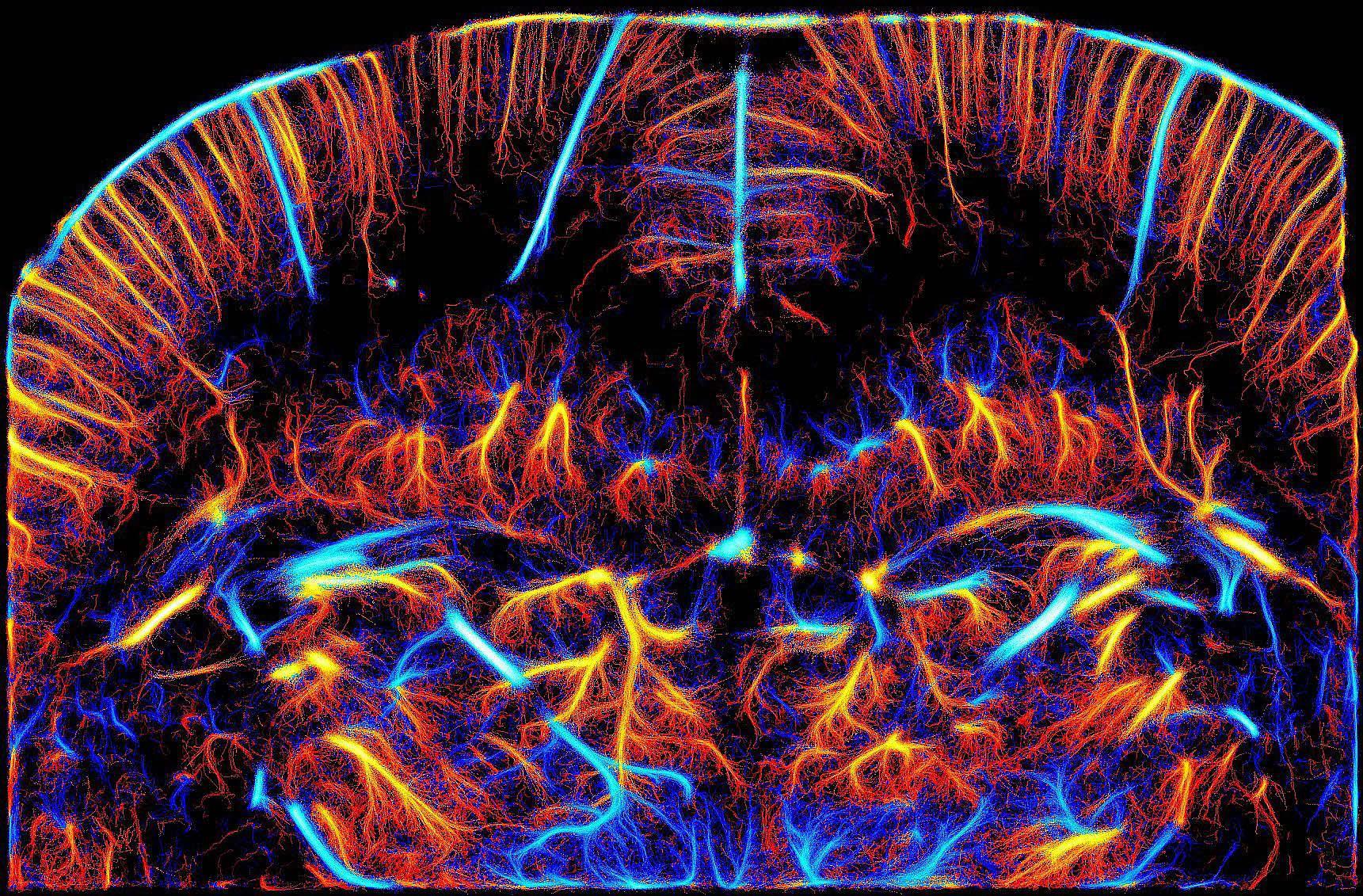 Сосудистая сеть человеческого мозга впервые показана в микроскопическом масштабе