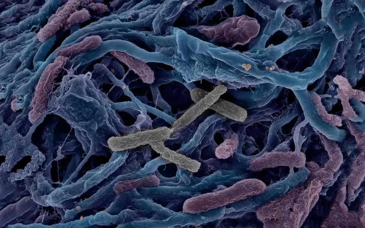 Биологами описан последний общий предок всех бактерий