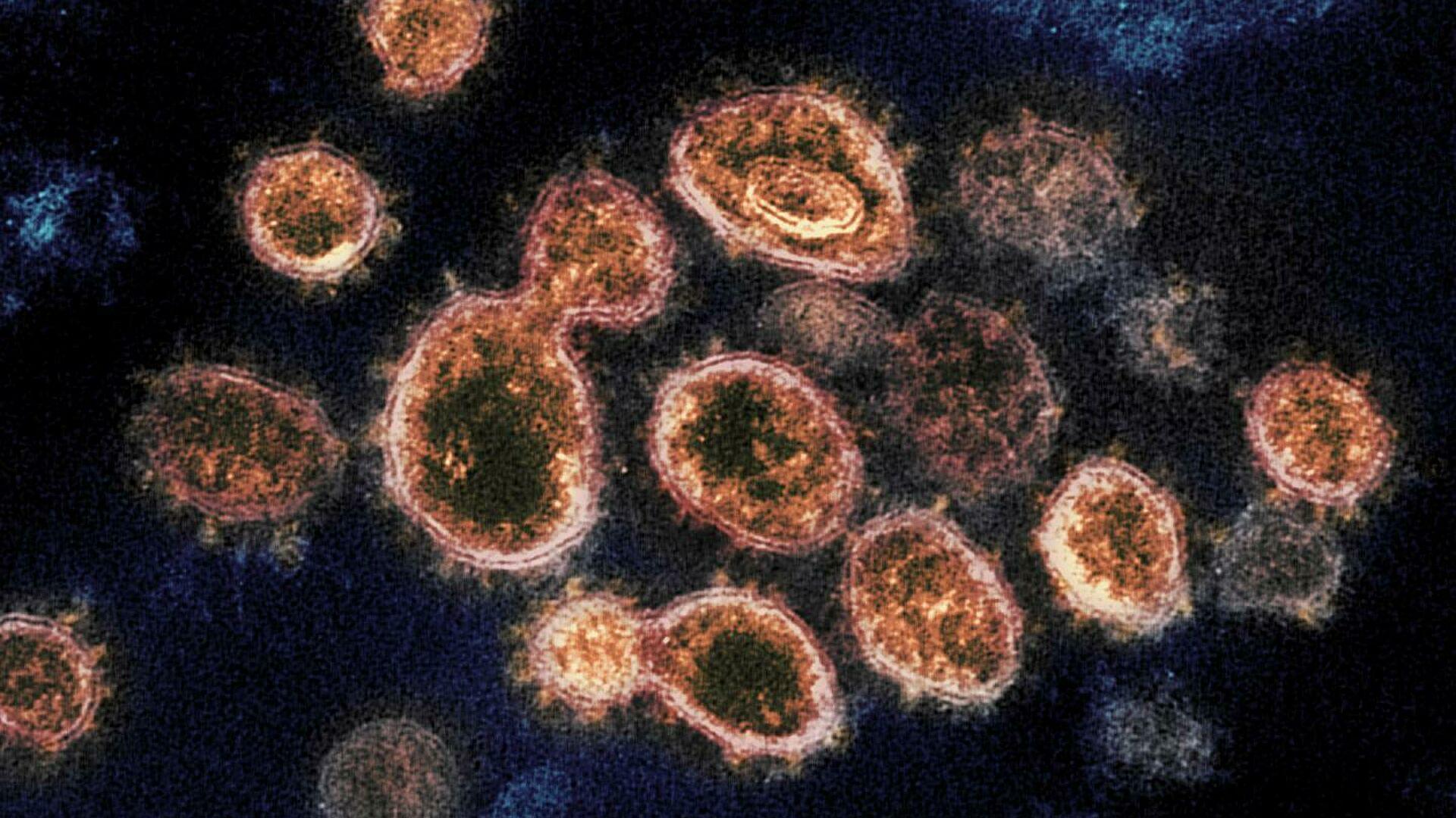 Человеческие антитела узнают разные коронавирусы
