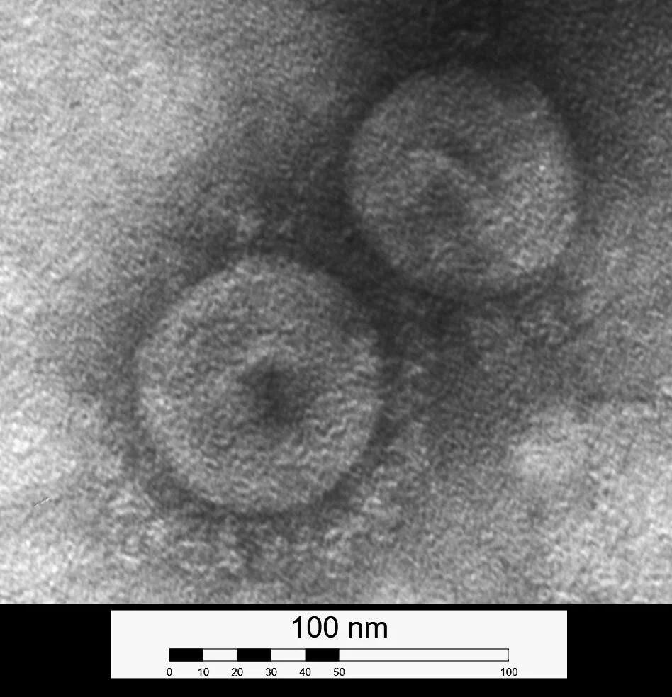 Животные передали новый рекомбинантный альфа-коронавирус своим хозяевам