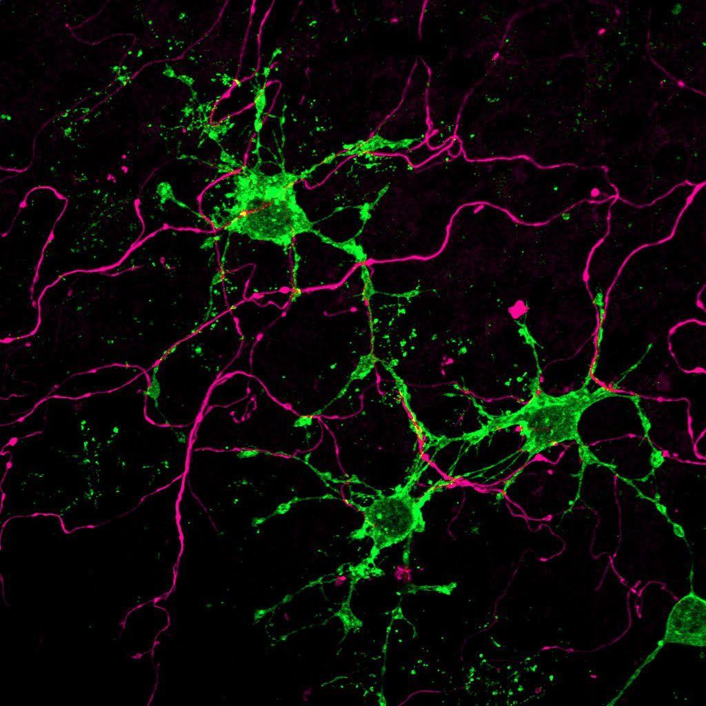 В головном мозге обнаружили новые глиальные клетки