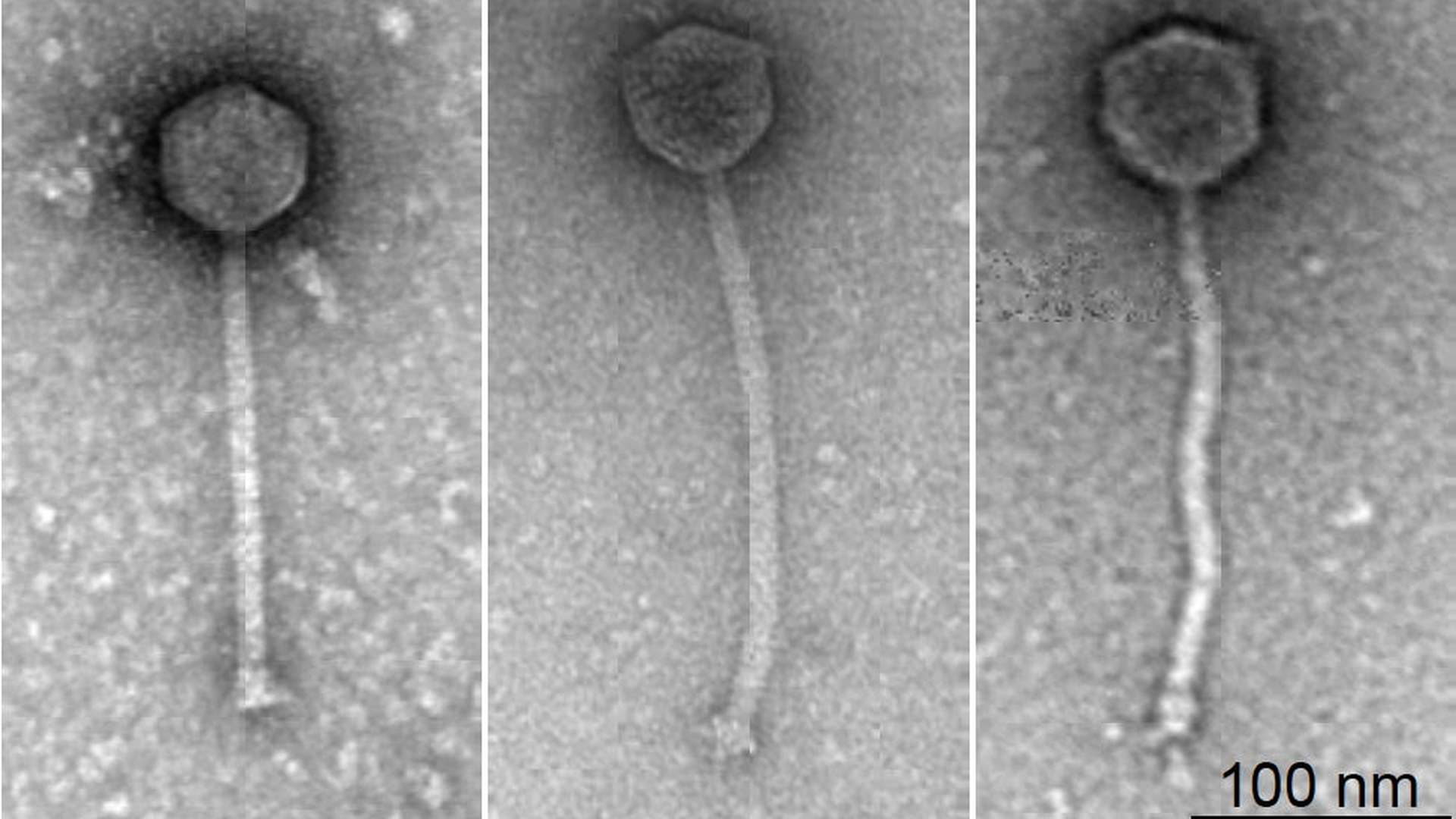 ГМ-бактериофаги впервые использовали для лечения антибиотикорезистентной инфекции