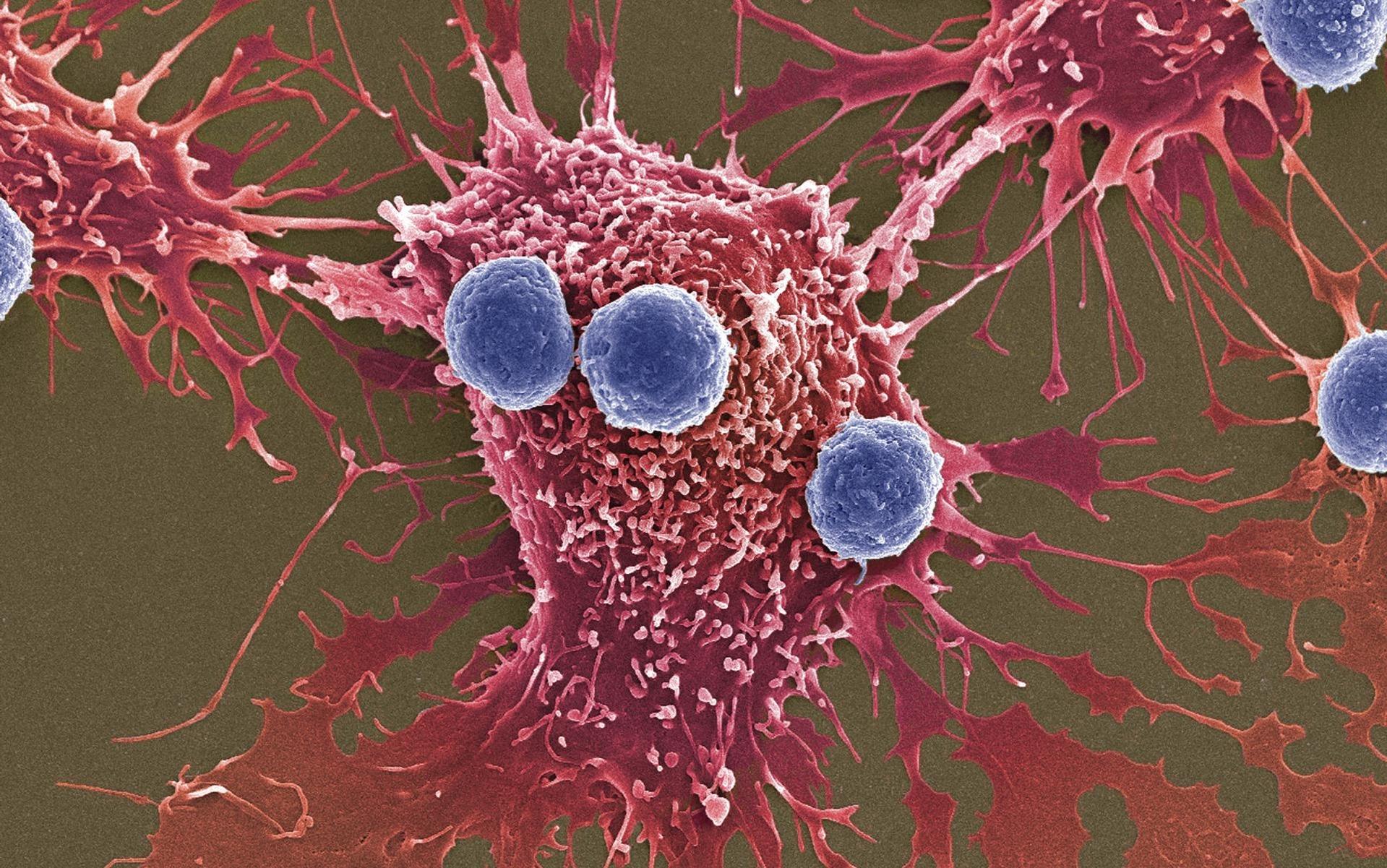 Исследование показало, как раковые клетки «едят» себя, чтобы выжить