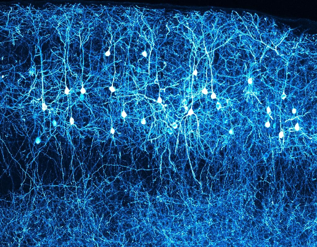 Как молодые нейроны укладываются в кору мозга