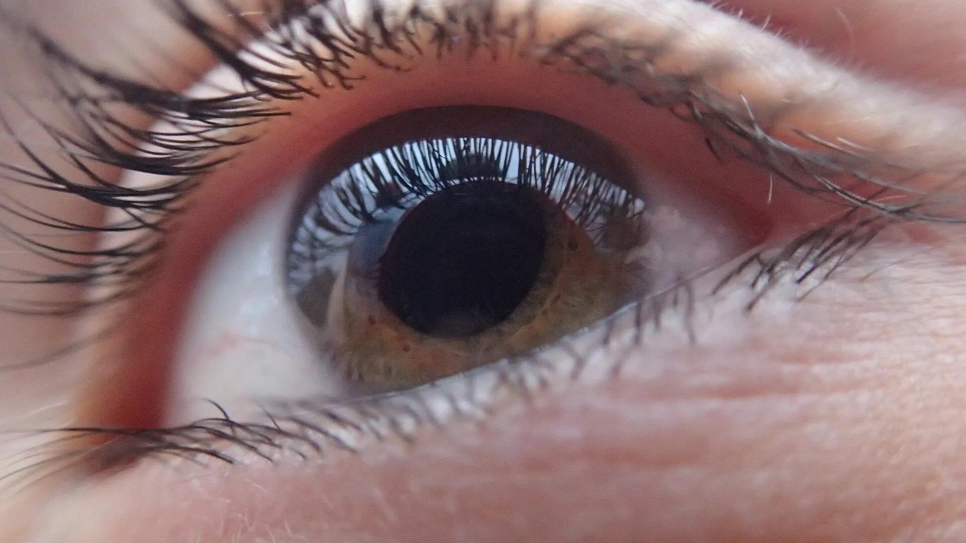 Исследователи нашли способ сохранять зрение при глаукоме