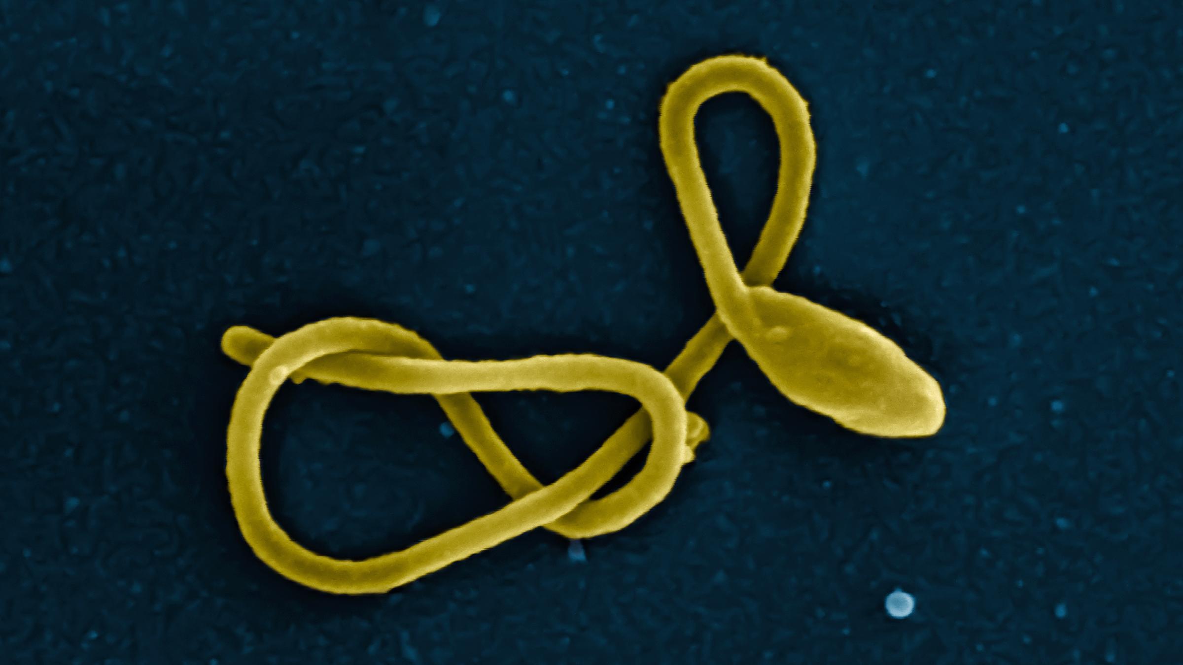 Вирус Эбола спит в людях
