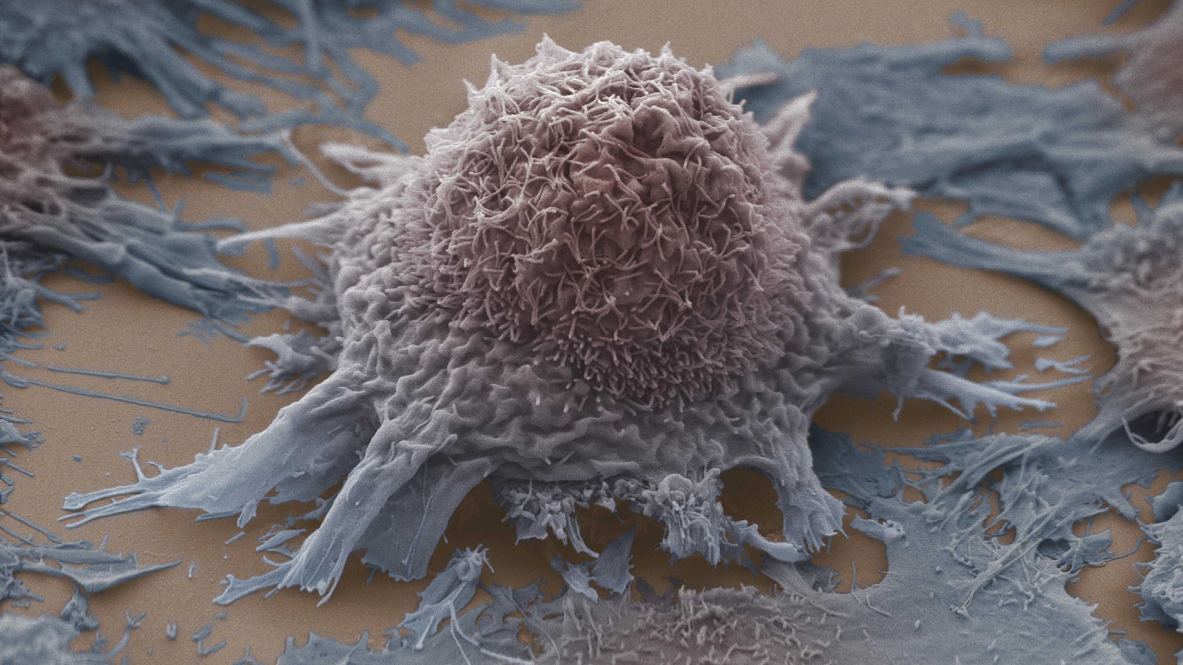 Голод не даёт расти раковым клеткам