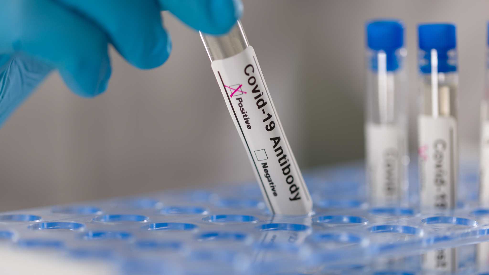В тест на коронавирусные антитела вносят поправки