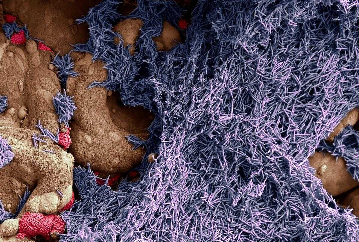 Плазмида с CRISPR/Cas9 убила патогенные штаммы в кишечнике мыши