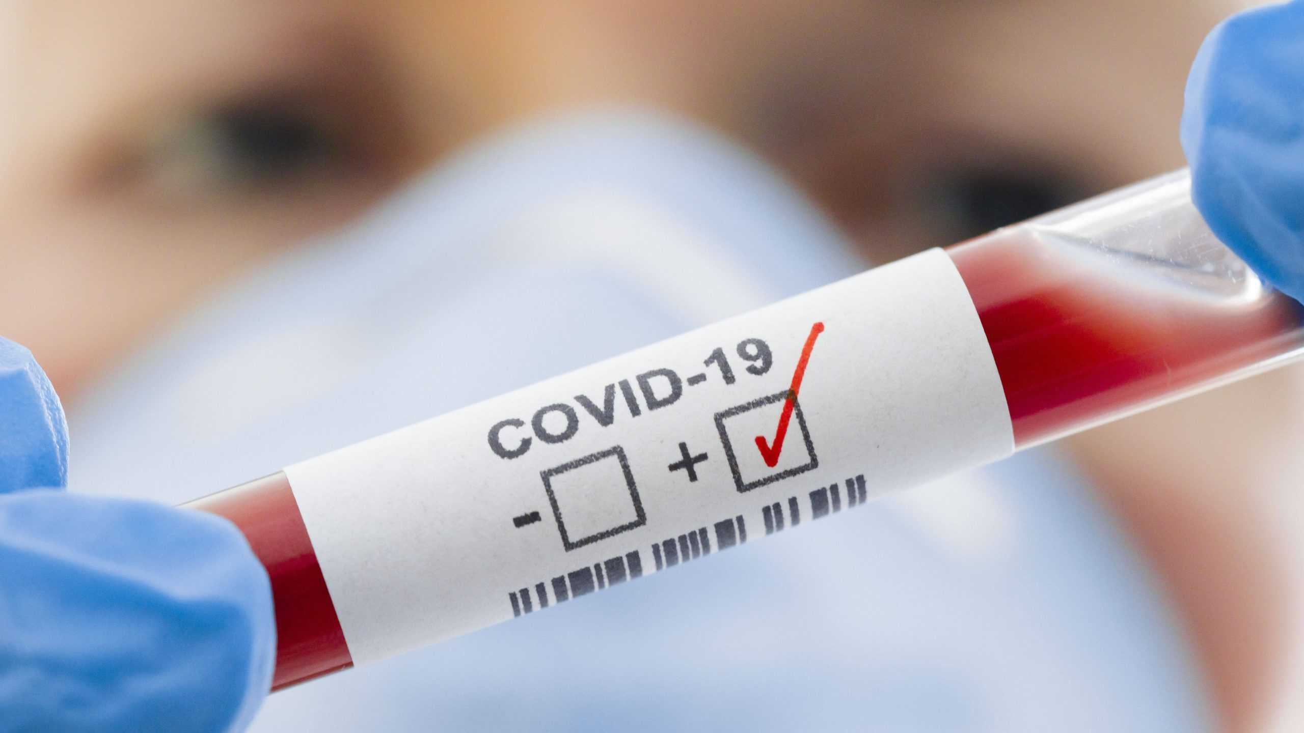 Опубликовано новое крупное исследование о вероятности повторного заражения COVID-19