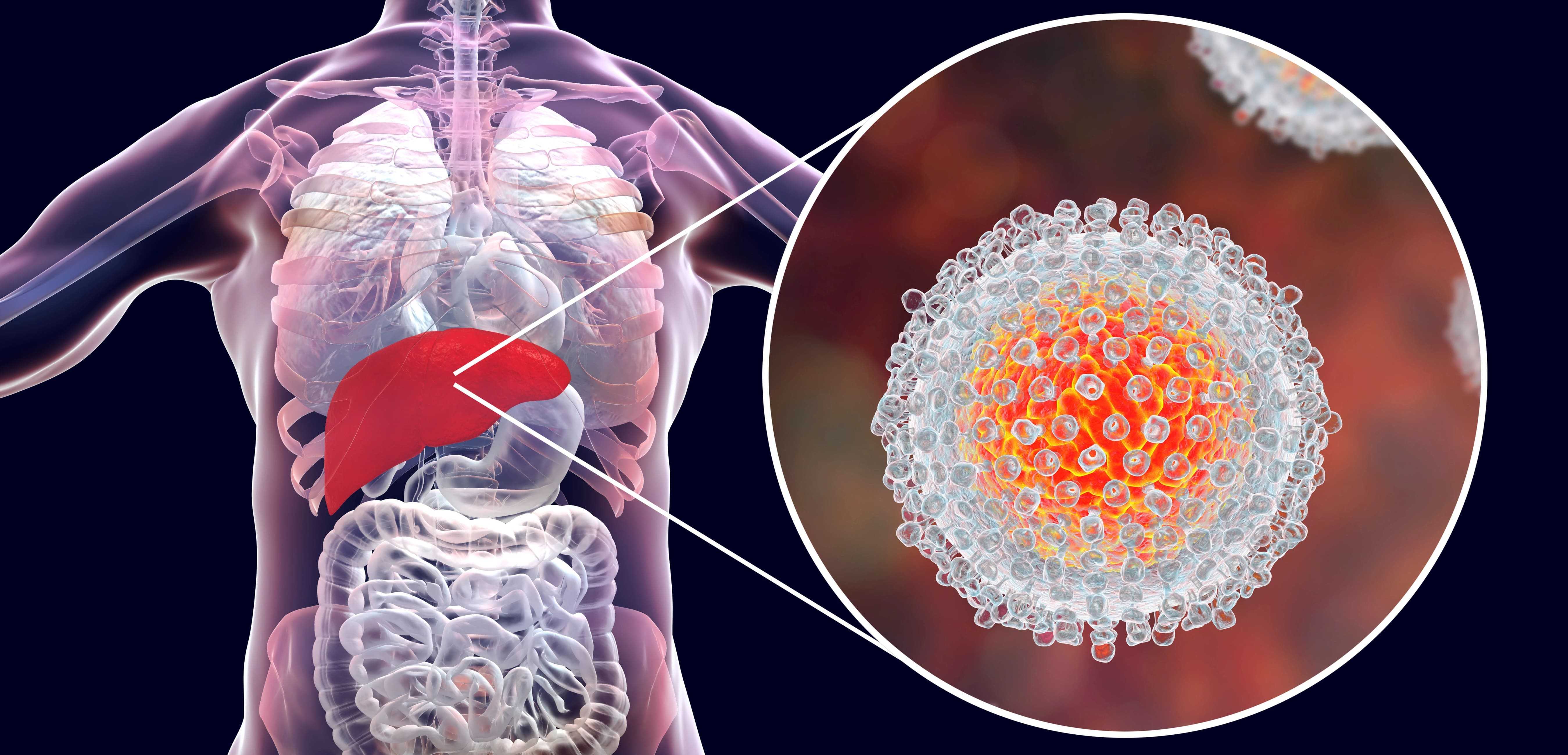 Гепатит B может изменять ДНК клеток печени за годы до выявления рака