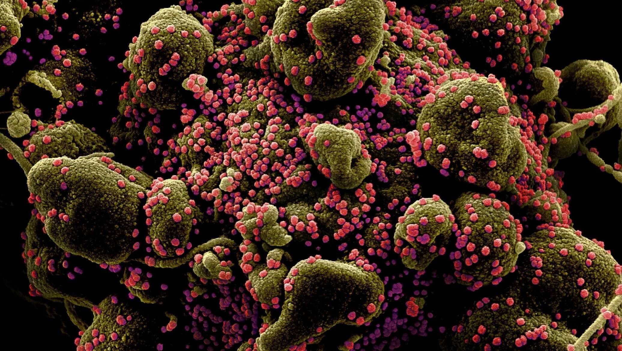 Коронавирус может сохраняться в тканях до 230 дней