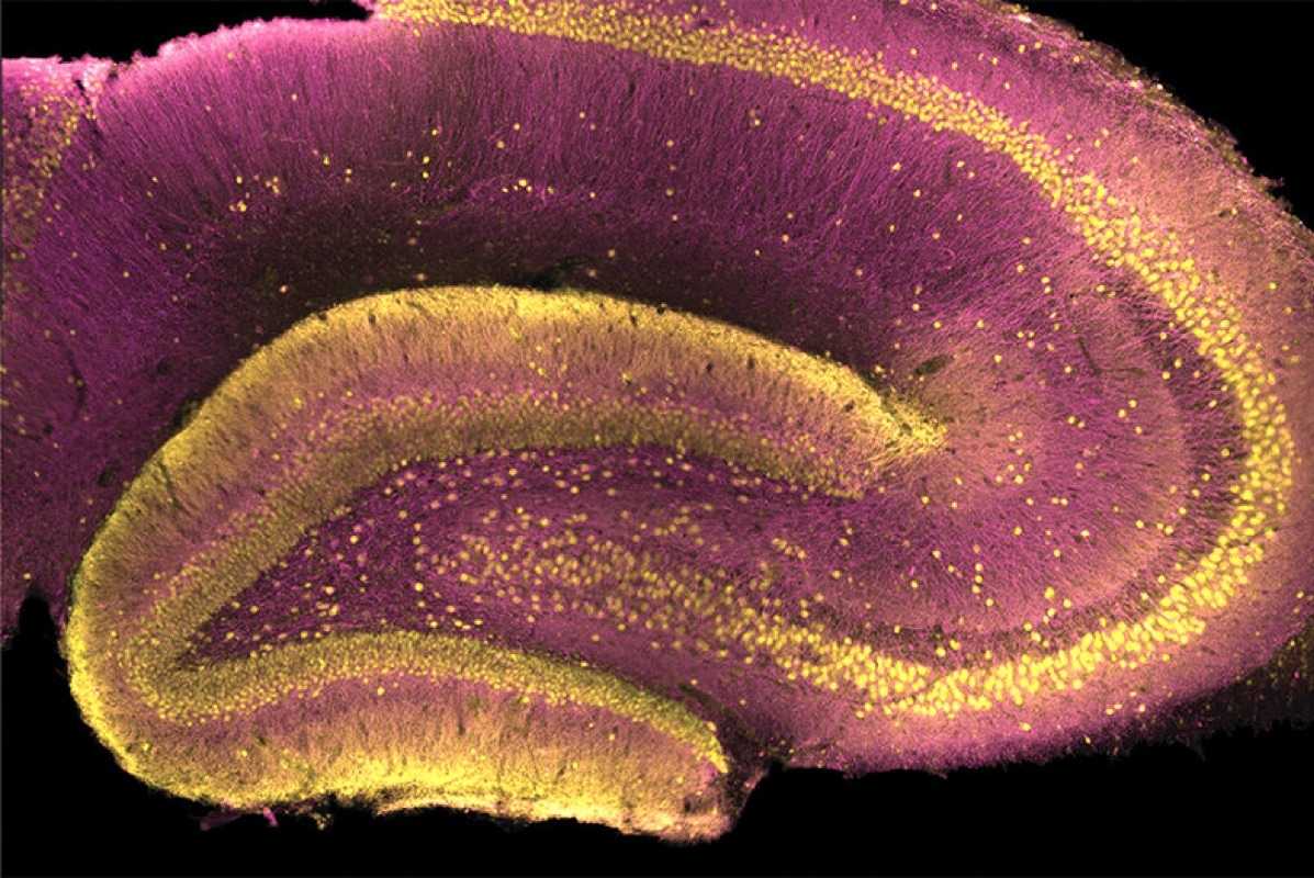 Ученые обнаружили белок, который может защищать от шизофрении