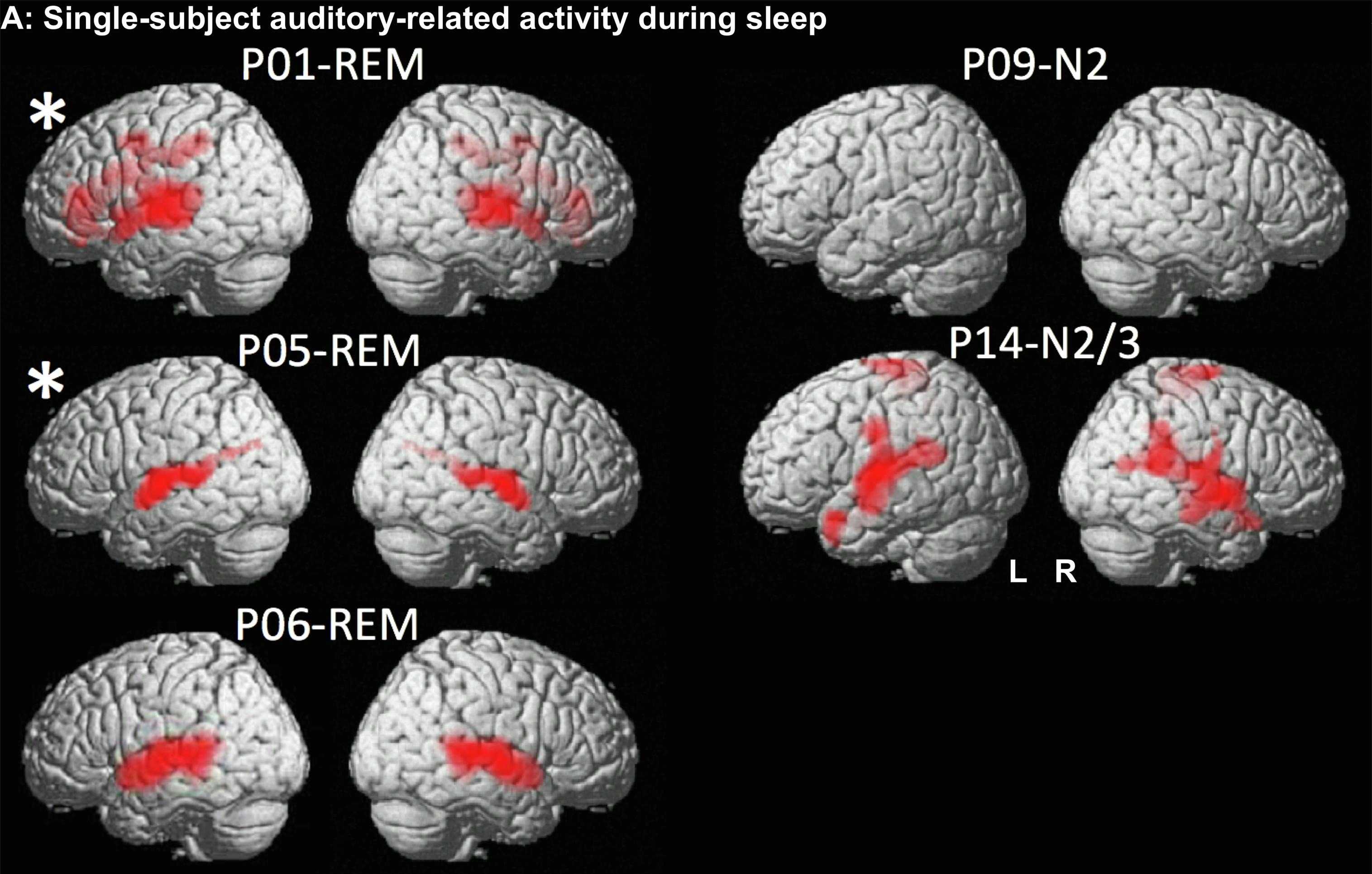Мозг осмысленно обрабатывает звуки во время быстрого сна