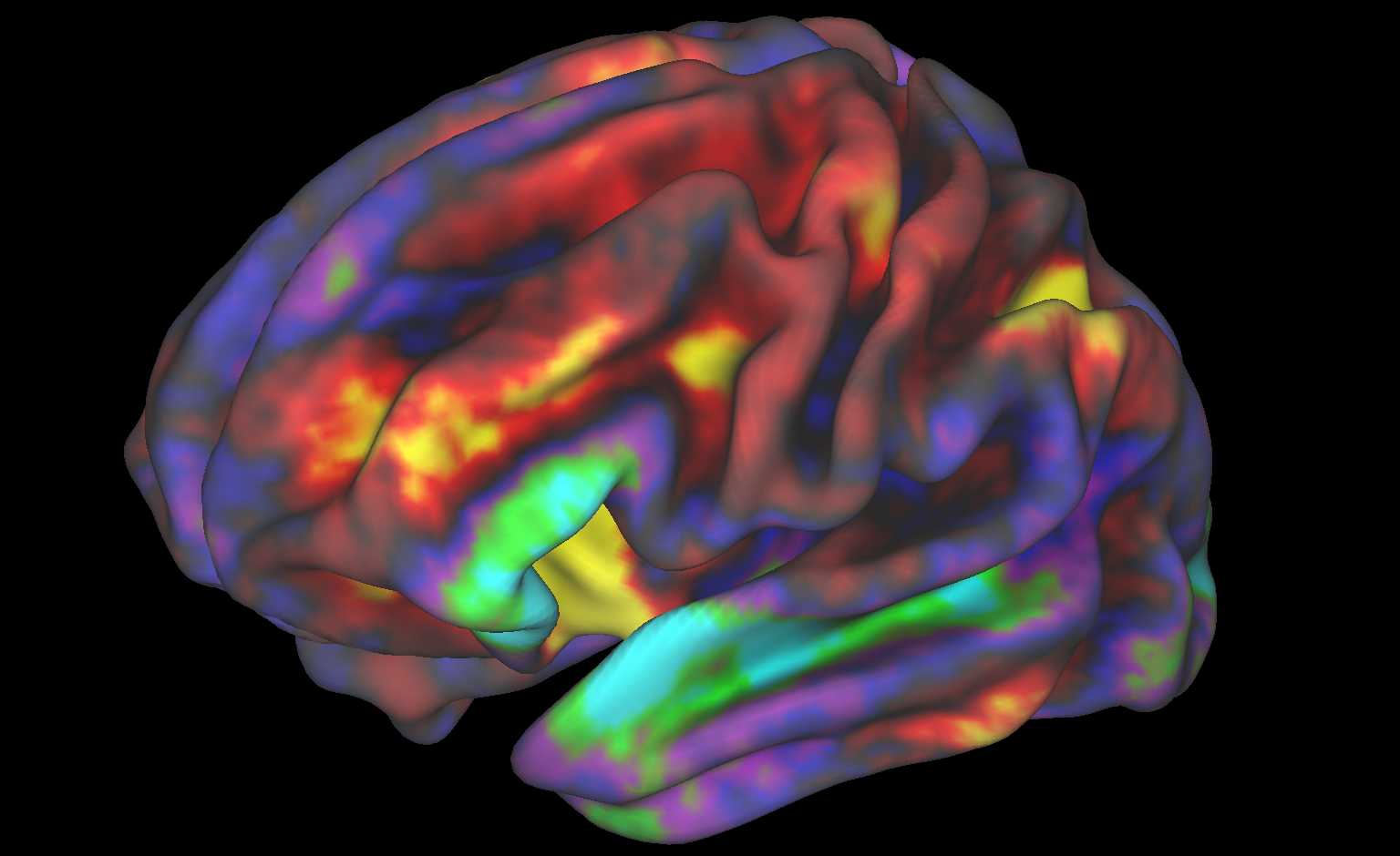 Ученые выяснили, как различается активность мозга при разных типах социального влияния