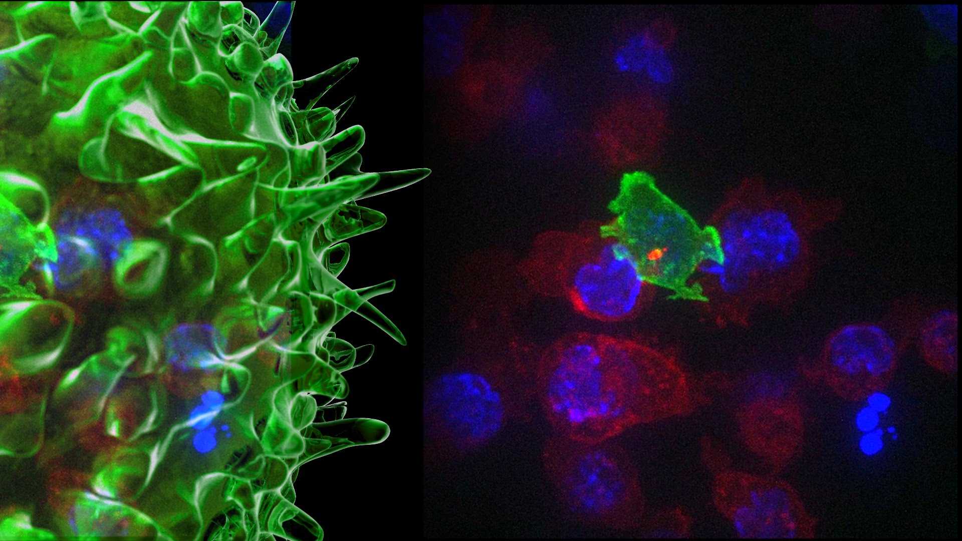 Иммунные клетки-убийцы борются с аутоиммунными болезнями
