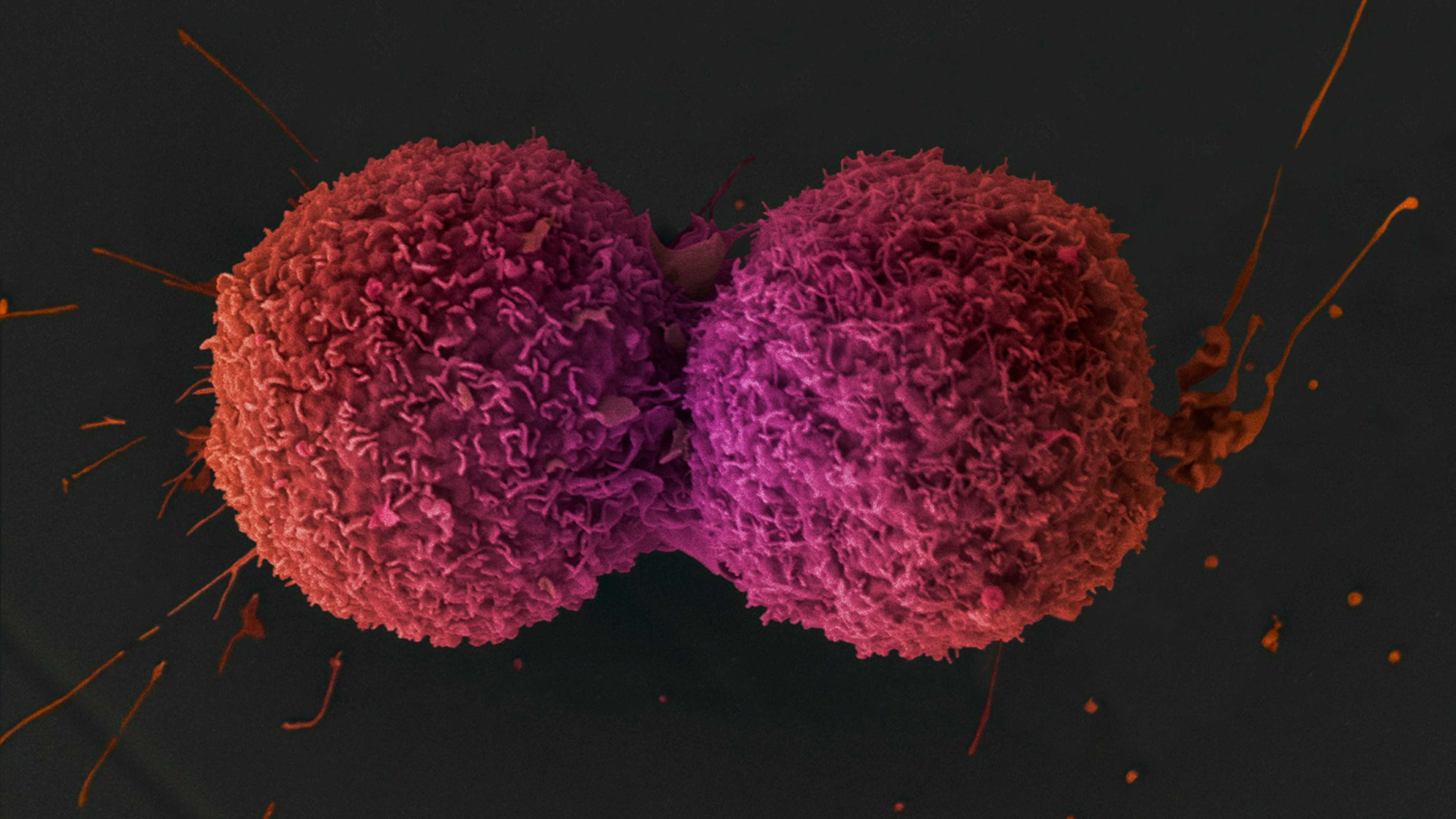 Раковые клетки рвут свою ДНК, чтобы выжить