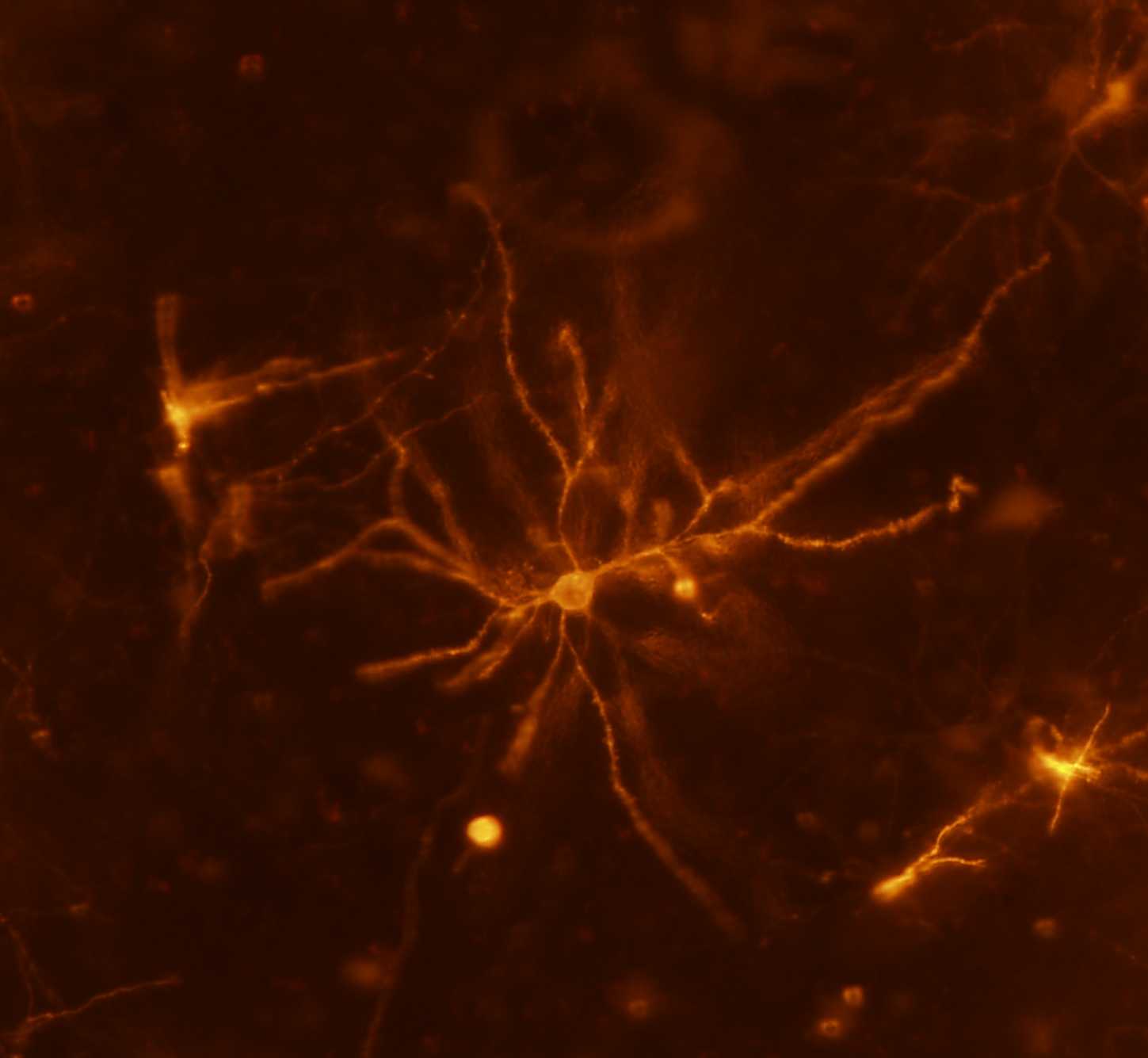 Как в мозге появляются нейроны памяти