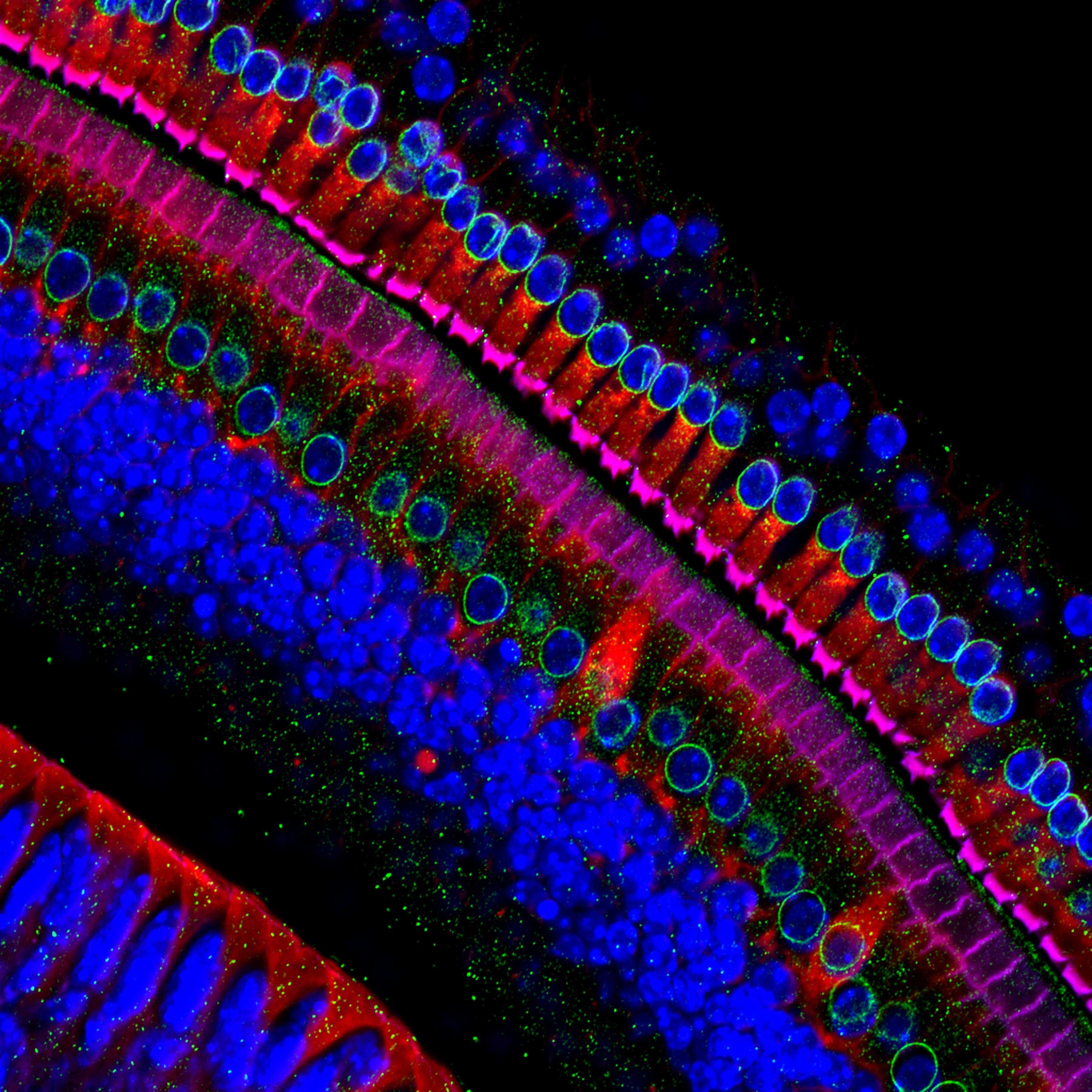 Генотерапия помогла исправить волосковые клетки во внутреннем ухе мышей