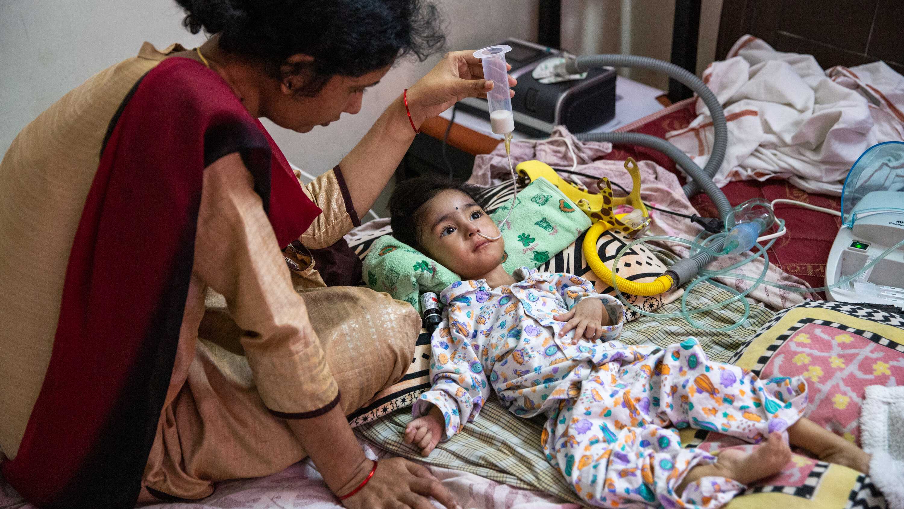У детей в Индии зафиксировали вспышку «томатного гриппа»