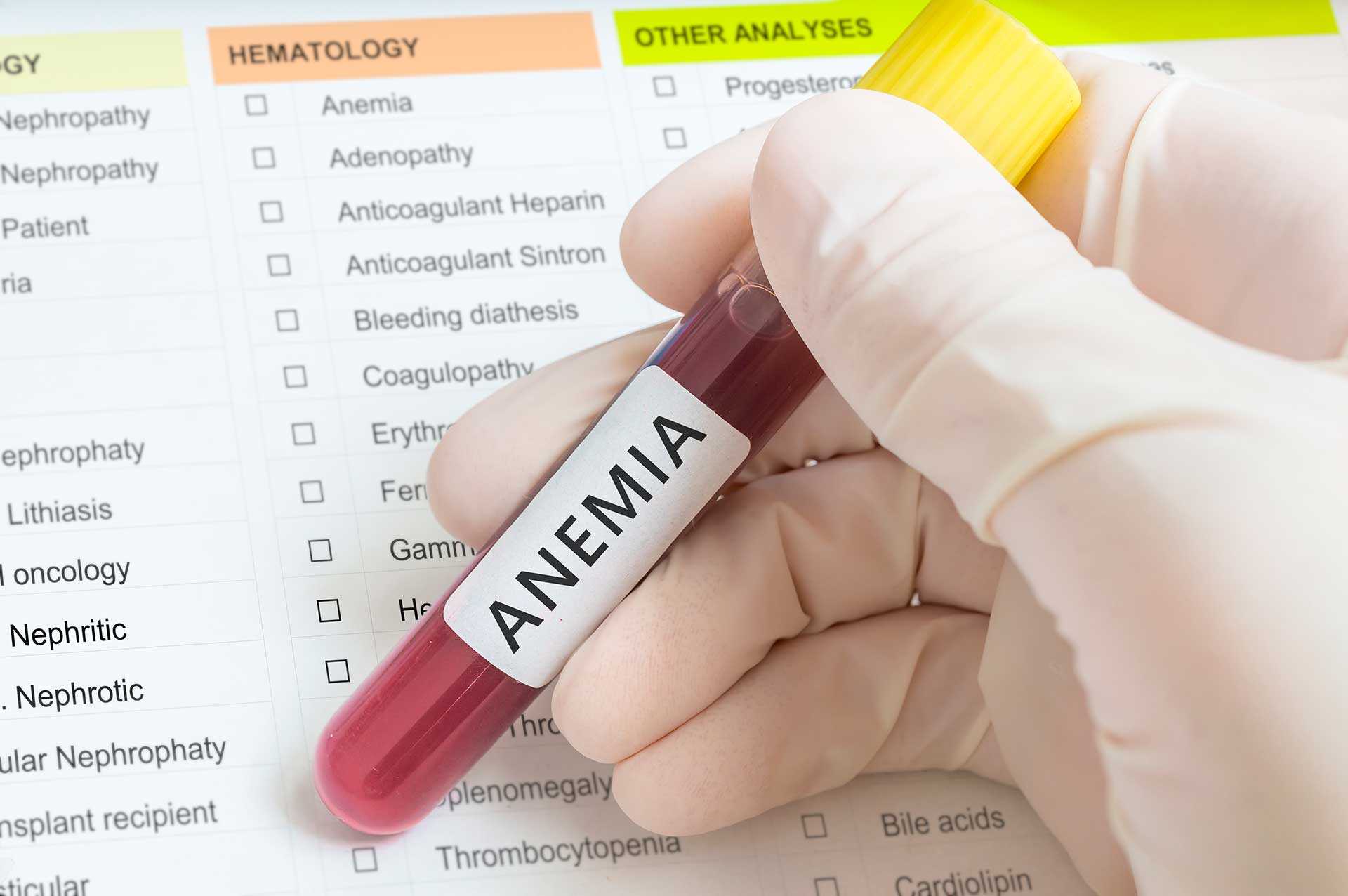 Причины железодефицитной анемии, которые могут стоить вам здоровья