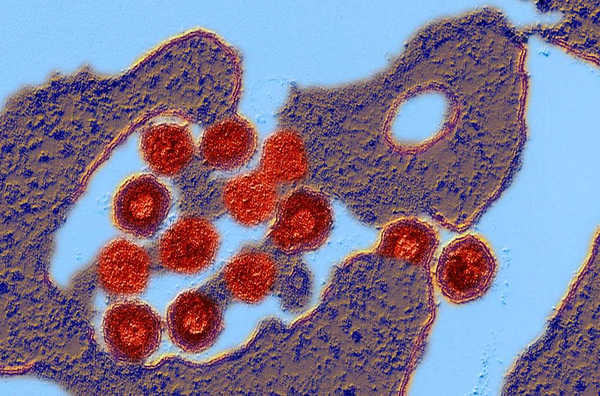 Остатки древнего вируса защищают эмбрионы от инфекций